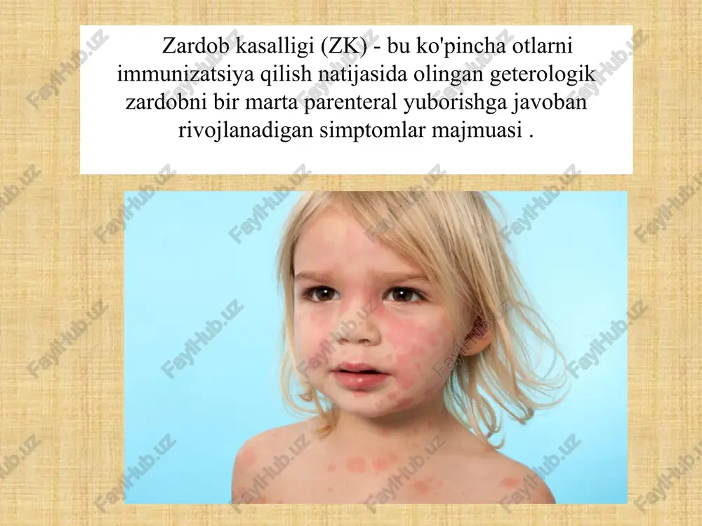 u protein katabolizmining intensivligini aks ettiradi. uchinchi bosqich antigenning qon oqimidan yo'qolishining yuqori tezligi bilan tavsiflanadi , bu antigenning antikorlar bilan bog'lanishining natijasidir, shuning uchun bu bosqich "antigenni yo'q qilishning immun bosqichi" deb nomlangan. zk rivojlanishida ishtirok etadigan antikorlar igg sinfiga kiradi va igm . e.i.karavayev zk bilan og'rigan bemorlarda terini sezgirlashtiruvchi antitellarni o'rganib chiqdi va reaginlar zkda majburiy emasligini va patogenezda etakchi rol o'ynamasligini ko'rsatdi . zk sindromi antigen-antikor immun komplekslariga ta'sir qilish natijasida yuzaga keladigan reaktsiya turiga ishora qiladi. to'qimalarning shikastlanishi o'z ichiga oladi komplement omili , klazkik turga ko'ra immun kompleksi shakllanish vaqtida faollashadi. immunofluoresans tadqiqotlari lezyonlarda to'qimalarni leykotsitlar kimyotaksisi, shuningdek, eksteraza ta'siri bilan yuqtiradi, deb ishoniladi . qon oqimidagi immun komplekslarning shakllanishi vazoaktiv moddalarning chiqarilishiga olib keladi va kinin tizimi faollashadi . o'tkir zardob kasalligida buzilishlar cho'kma bilan bog'liq buyrak glomerulyar tomirlari devorlari bo'ylab va ichida eruvchan immun komplekslar . glomeruli ko'pincha shikastlanadi va immun komplekslari, …