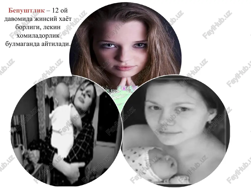 davomida bazal temperatura 37s gacha saklansa, bu monofazali (bir fazali) deb nomlanadi. ovulyatsiya yukligidan buladi. bazal temperatura - asosan tugri ichakda (ogizda yoki kinda xam) ulchanadi. bazal xarorat va ulchash bir vaktning uzida fakat bir soxada butun menstrual tsikl davomida 1 soxada birta gradusnik bilan 4-5 sm ga tugri ichakka kiritiladi v 2-3 menstrual tsikl davomida 5-7 minut davomida ertalab uykudan keyin joydan turmasdan 1 vaktda bazal xarorat. gormonal tekshirishlar utkazish maksadi. gormonlarni aniklash 2 – 5 va 20-23 kun menstrual tsiklida. gormonal uzgarish xarakterini baxolash maksadida gormonal sinamalar xam utkaziladi. tuxumdon funktsiyasini baxolash endokrin bezlar funktsiyasini baxolash kondagi gormonlar kontsentratsiyasining aniklash gsg gsg (gisterosalpingografiya) — kup kullaniladigan rengenologik usul xisoblanib, bachadon bushligi va bachadon naylariga kontrast modda yuborilib rengenogramma kilinadi. kontrast moddaning korin bushligiga tukilishi naylar utkazuvchanligidan dalolat beradi. bundan tashkari gsg endometriy poliplari, shillik osti miomasi va bachadon anomaliyasini aniklaydi. gisterosalpingografiya (gsg) ultratovush monitoringi ultratovush monitoringi — bu …