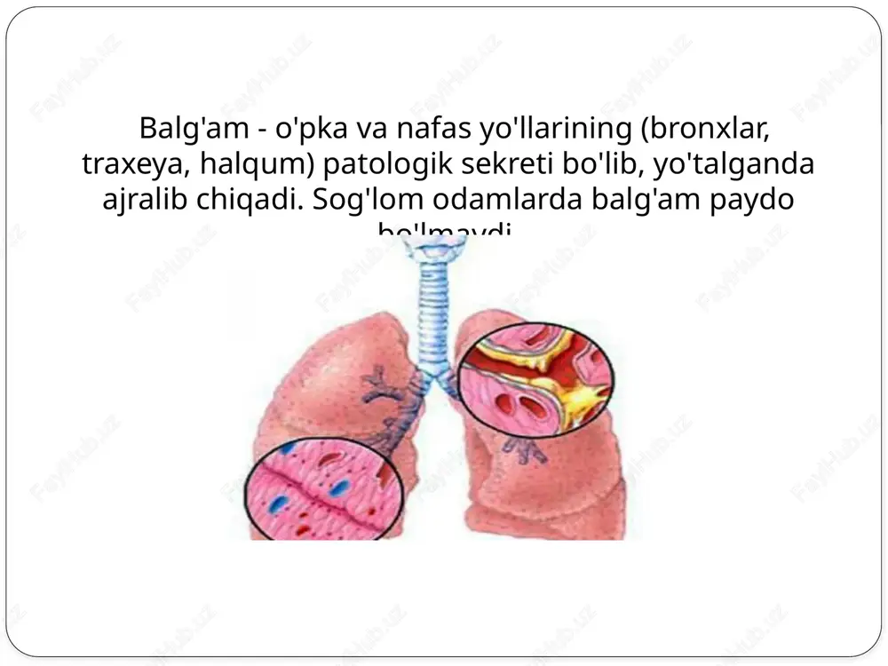 nxial astmada balg'am shishasimon bo'ladi; ● yiringli balg'am - sariq yoki sariq -yashil rangli, ko'pincha badbo'y hidga ega. bu bronxoektazlar, surunkali o'pka absessida bo'ladi. ● seroz balg'am - rangsiz, suyuq, ko'pikli. bu o'pka shishi uchun xarakterlidir, bronxial adenomada ham hosil bo'ladi; ● qonli balg'am – qizil rangda, suyuq. takibida eritrositlar mavjud. u turli xil kasalliklarda uchraydi va jiddiy differentsial tashxisni talab qiladi. hidi yangi chiqarilgan va yiringi bo'lmagan balg'amning hidi bo‘lmaydi. yiringli jarayonlarda badbo'y hidga ega. patologik aralashmalarga quyidagilar kiradi: fibrin laxtasi, shilliq- oq -kulrang durdachalar shaklida ucharaydi. krupoz pnevmoniyaga xos yoki bronxial astma bilan og'rigan bemorlarda bo'g'ilish xurujidan keyin yo'talganda chiqarilishi mumkin; ditrix tiqinlari oq-sarg'ish rangda, badbo'y hid chiqaradi - bronxda surunkali yiringli jarayonga xosdir. balg'amning mikroskopik tekshiruvi : ● leykotsitlar - yallig'lanish jarayonining mavjudligini ko'rsatadi ● eritrotsitlar - o'pka to'qimasi nekrozi, pnevmoniya, o'pka infarkti va b. kasalliklarda balg‘amda paydo bo‘ladi. ● eozinofillar - ularning mavjudligi allergik yallig'lanishni ko'rsatadi. …