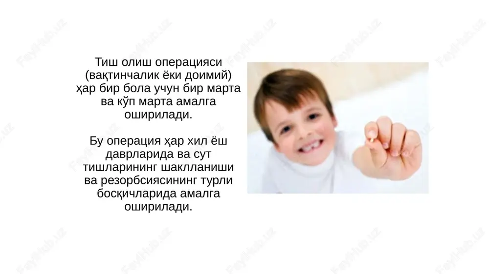 nish jarayonlari periodontit 9 vaqtinchalik tishni olish uchun ko'rsatmalar odontogen yallig'lanish jarayonlari bolalarda o'tkir seroz periostit o'tkir pulpit bilan birga bo'lishi mumkin, bunda tish saqlanishi ko'rsatiladi (ildiz rezorbsiyasi darajasini hisobga olgan holda). o'tkir yiringli periostit-bitta va ko'p ildizli tishlarni olib tashlash uchun ko'rsatma utkir periostit 10 vaqtinchalik tishni olish uchun ko'rsatmalar odontogen yallig'lanish jarayonlari bolalardagi jag'larning o'tkir va surunkali osteomieliti vaqtinchalik bitta va ko'p ildizli tishni olib tashlashning mutloq belgisidir. o'tkir va surunkali osteomielit 11 vaqtinchalik tishni olish uchun ko'rsatmalar odontogen yallig'lanish jarayonlari o'tkir odontogen limfadenti, absess va flegmonalar 12 vaqtinchalik tishni olish uchun ko'rsatmalar jag'ning odontogen yallig'lanishli kistalari 13 vaqtinchalik tishni olish uchun ko'rsatmalar yuz jarohati o'tkir tish jaroxatlari 1 . tugallanmagan tish chiqishi 2. to'liq tish chiqishi 3. ta'sir qilingan tish chiqishi 4. tish sinishi 14 vaqtinchalik tishni olish uchun ko'rsatmalar tishning to'liq bo'lmagan chiqishi davolash usuli harakatchanlik darajasiga bog'liq; tish ildizining nisbiy holati va doimiy tishning mikroblari; …