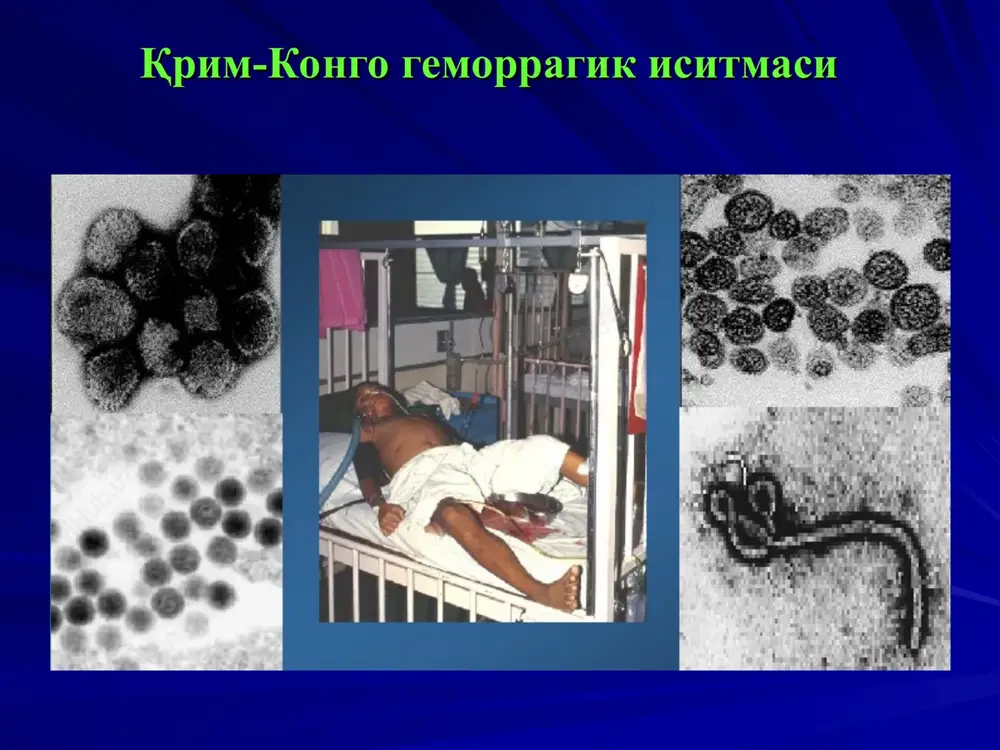 qrim-kongo gemorragik isitmasi - Page 2