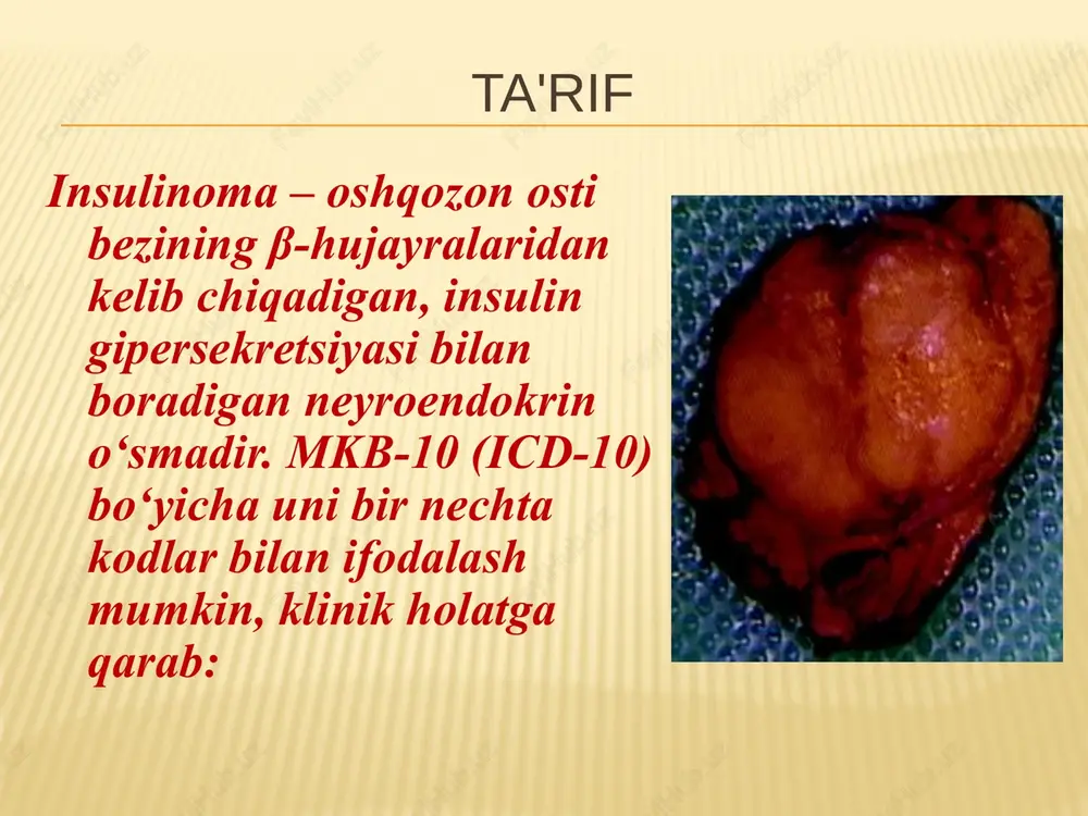 l bo‘ladi. 2️⃣ ortib ketgan insulin sekretsiyasi • o‘sma hujayralari avtonom tarzda, ya’ni qondagi glyukoza miqdoridan qat’i nazar insulin ishlab chiqaradi. • normal sharoitda glyukoza < 3,5 mmol/l bo‘lsa, insulin sekretsiyasi to‘xtaydi, lekin insulinoma hujayralari bunday nazoratga bo‘ysunmaydi. ‹#› 3️⃣ gipoglikemiya rivojlanishi • ortiqcha insulin qondagi glyukozani hujayralarga majburan olib kiradi → qonda glyukoza keskin pasayadi. • glyukozaning yetishmasligi birinchi navbatda miya neyronlarida energiya tanqisligini keltirib chiqaradi (miyaning asosiy energiya manbai glyukozadir). ‹#› klinik ko'rinishlar adrenergik belgilar : titroq; taxikardiya; sovuq ter; ochlik; qo'rquv; paresteziya. klinik ko'rinishlar neyroglikopeniya belgilari: asteniya; nutq, vizual, xatti-harakatlarning buzilishi; amneziya; konsentratsiyaning pasayishi; bosh og'rig'i; uyquchanlik ; konvulsiyalar; falaj; koma. ‹#› rivojlanishda​ gipoglikemik reaktsiyalar 5 bosqich i bosqich - kortikal ii bosqich - subkortikal-diensefalik iii bosqich - gipoglikemiya iv bosqich - aslida koma v bosqich - chuqur komalar ‹#› diagnostika 1) uch kunlik ochlik testi, uning maqsadi insulinoma uchun patognomonik reaktsiyani qo'zg'atishdir. uipp triadasi : - …