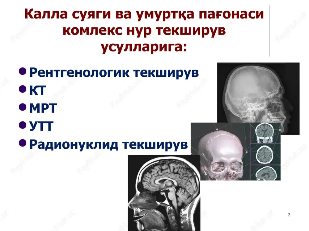 lig'i 29.g'alvirsimon suyak labirenti ‹#› ensa peshona xolati 1- peshona bo'shlig'i 2- sagittal chok 3. tojsimon qirra 4- lyambdasimon chok 5- chakka sugining tosh qismi 6- ichki eshituv yo'li 7- so'rg'ichsimon o'simta 8- ensa suyagining asosi 9- atlantning yonbosh o'sig'i 10- aksisning tishsimon o'sig'i 11- yuqorigi jag'ining tubi 12- burun to'sig'i 13- turk egari 14-g'alvirsimon suyak kataklari 15- ko'z kosasining yuqori suyak yorig'i 16-asosiy suyak qanotining chakka yuzasi 17- asosiy suyakning tanasi 18- asosiy suyagning kichik qanoti ‹#› yon xolat 30.so'rg'ichsimon kataki 31.aksis tishi 32.barmoq bosilgan izlari 33.tilosti suyagining katta shoxi 34.peshona suyagining tashqi platinkasi 35.peshona suyagining ichki platinkasi 36. sagittal chok 37. atlantning old yoyi 38. aksis. 1.ensa suyagining asos qismi 2. egat 3.ensa qirrasi 4.tashqi ensa bo'rtig'i 5. ichki ensa bo'rtig'i 6.ichki ensa qirrasi 7.lambdasimon chok 8.tepa suyagi 9. diploik kanal 10.ponasimon suyak katta shoxining tepa burchagi 11.tangachasimon chok 12.tojsimon chok 13.peshona suyagi 14.g'alvirsimon suyak g'alvirsimon plastinkasi 15.g'alvirsimon …