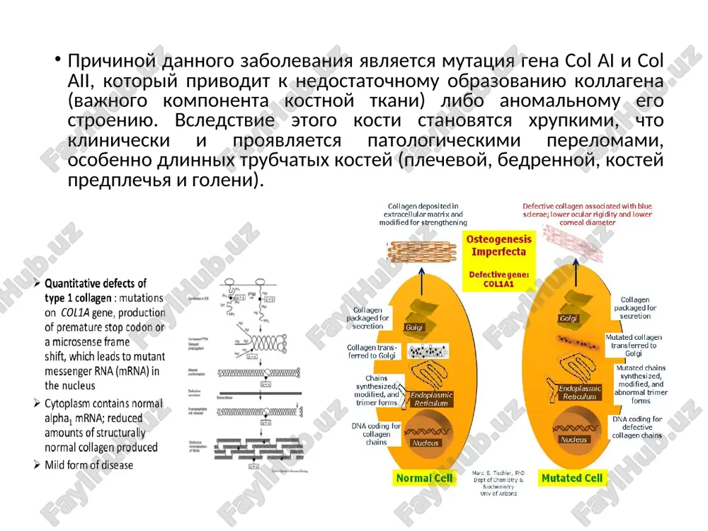 , esli dannim zabolevaniem stradaet xot odin iz ego roditeley. v takom sluchae perelomi chashe voznikayut posle pervogo goda jizni. pri autosomno-retsessivnom tipe nasledovaniya (xarakteren dlya 7 i 8 tipov). bolnimi rojdayutsya te deti, roditeli kotorix imeyut mutatsiyu gena col ai ili col aii. u takix bolnix techenie zabolevaniya bolee tyajeloe: mnojestvennie perelomi voznikayut vo vremya beremennosti materi ili srazu je posle rodov. diagnostika analiz anamneza i jalob zabolevaniya: povishennaya lomkost dlinnix kostey konechnostey s posleduyushim izmeneniem ix formi i ukorocheniem; sero-sinie skleri (belki) glaz; snijenie sluxa vplot do polnoy ego utrati posle 20-30 let. semeyniy anamnez: nalichie zabolevaniya u odnogo iz roditeley ili u dalnix rodstvennikov. diagnostika rentgenologicheskaya kartina zavisit ot tyajesti dannogo zabolevaniya. osnovnim klinicheskim priznakom yavlyaetsya rasprostranenniy osteoporoz (umenshenie plotnosti kosti, sposobstvuyushee snijeniyu ee prochnosti) vsego skeleta. otmechayutsya: znachitelnoe istonchenie narujnogo kompaktnogo sloya dlinnix trubchatix kostey (bedrennoy, plechevoy, predplechya i goleni); umenshenie diametra kosti; patologicheskie perelomi s …