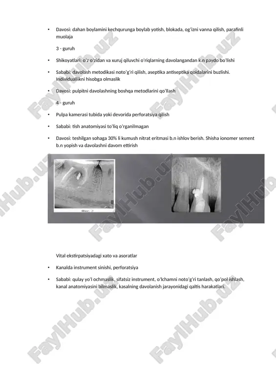 i. ekstirpatsiyadan keyingi qonash · to’liq ekstirpatsiya qilmaslik, pulpani yirtilib olinishi, apical yoriqdan uzilishi va o’sha yerda gematoma paydo bo’lishi · yordam: qon to’xtatuvchi moddalar: peroksid, aminokapron kislota. diatermokoagulyatsiya plombadan keyingi doimiy va tishlaganda kuchayuvchi og’riqlar · sababi: aseptika qoidalari buzlishi, periodontni ta’sirlantiruvchi moddalar ishatish, silerni noto’g’ri tanlash, kanaldan siler chiqishi yoki to’liq yetib bormasligi, instrumental travma. · yordam: fizioterapiya (gidrokortizon b.n), davolovchi damlamalar b.n chayish, kanalni rentgent nazoratida qayta plombalash 5 - guruh · mishyakli pastalarni qo’ygandan k.n paydo bo’luvchi og’riqlar · sababi: mishyakni to’liq ochilmagan pulpa kamerasiga qo’yish yoki qo’ygandan keying qattiq tamponade · yordam: qo’yilganlarni olib tashlab boshqatdan qo’yish, ustidan paxtali tampon qo’yish va germetik yopish. pulpa kamerasini ochilganligini tekshirish. papillit, lokalizatsiyalashgan parodontit · mishyakli pastani milk so’rg’ichi yoki tishlararo oraliqqa tushishi · yordam: o’sha sohani to’liqligicha ko’zdan kechirish, tozalash. 5% li unitiol, yod nastoykasi, yalliglanishga qarshi va regeneratsiyalovchi terapiya o’tkazish · amputatsiyadan keyin kanal og’zi zondlanganda …