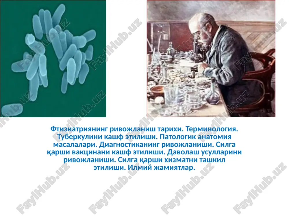 ko'pgina ijobiy tomonlari bor ekan, ya'ni vaktsinatsiya qilingan bolalar orasida silning og'ir,sil meningiti va destruktiv turlari kam uchragan, o'lim kamaygan. 1925 yili sovet olimi professor tarasevichga, a.kalmett tomonidan vaktsina shtammi berilgan. istoriya tuberkuleza legkix delitsya na 2 epoxi: doantibakterialnuyu i sobstvenno antibakterialnuyu. do tex por, poka ne bilo obnarujen deystvenniy sposob borbi s vozbuditelem, legshiy v osnovu lekarstv ot tuberkuleza, eto zabolevanie privodilo k neminuemoy gibeli bolnogo. perelomniy moment nastupil v 1944 godu, kogda bil otkrit streptomitsin – perviy preparat, kotoriy pokazal klinicheskuyu effektivnost pri lechenii etogo letalnogo na tot moment zabolevaniya. pervoe effektivnoe lekarstvo ot tuberkuleza-streptomitsin, razrabotal chelovek, zanimayushiysya pochvovedeniem. eto bil zelman vaksman, kotoriy, kstati, poluchil za eto otkritie nobelevskuyu premiyu. «tuberkulez»- ot lotinskogo «tuberculum» -bugorok; starie nazvaniya etogo zabolevaniya - bugorchatka i chaxotka. «chaxotka, grecheskoe nazvanie ftiza i uzbeksoe sil» imeyut odinakoviy smisl, oznachayushiy uvyadat. ftiziatriya s grecheskogo yazika oznachaet phtisis – istoshenie i treat –lechebnoe uchrejdenie. …