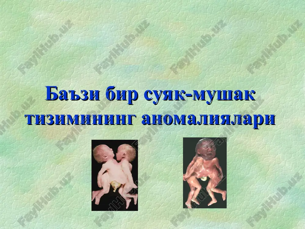 tug'ruqxonada- akusherka, neonatolog 4 haftada- bolalar poliklinikasi - bolalar ortopedi 6 oyda- bolalar poliklinikasi - bolalar ortopedi diagnostika: anamnez; utt; chanoq-son bo'g'imi suyaklari reografiyasi. xilgenraynera sxemasi . a –kelera liniyasi h – perependikulyar metafizning eng yuqori qismidan kelera chizig'igacha ( 1 sm gacha). b –ombredana liniyasi l – atsetabulyar burchak (indeks) . normada 30 dan yuqori ( yatch larda) putti sxemasi xilgenreynera sxemasi rentgenografiya va kompyuterno-tomografik taxlillar kompyuter tomogrammasida son suyagi bo'yinchasi chin antiverviyasini aniqlash son suyagi tug'ma chiqishida chanoq-son bo'g'imini kontrast tekshirish standart artrografiya mrt son suyagi tug'ma chiqishi klinikasi simptom ortolani-marksa – shiqillash simptom barlou- sonning orqaga siljishi simptom galeatstsi – sonning qisqarishi son abduktsiyasining chegaralanish simptomi teri burmalari asimmetriyasi oyoqlarning tashqi rotatsiyasi son suyagi boshchasining ortiqcha harakatchanligi ortolani-marks simptomi bola hayotining ilk haftalaridan namoyon bo'ladi simptom barlou simptom galeatstsi son abduktsiyasining chegaralanish simptomi teri burmalari asimmetriyasi tug'ma son chiqishining kechki belgilari normal rivojlanayotgan bola 8-12 oylikda yura …