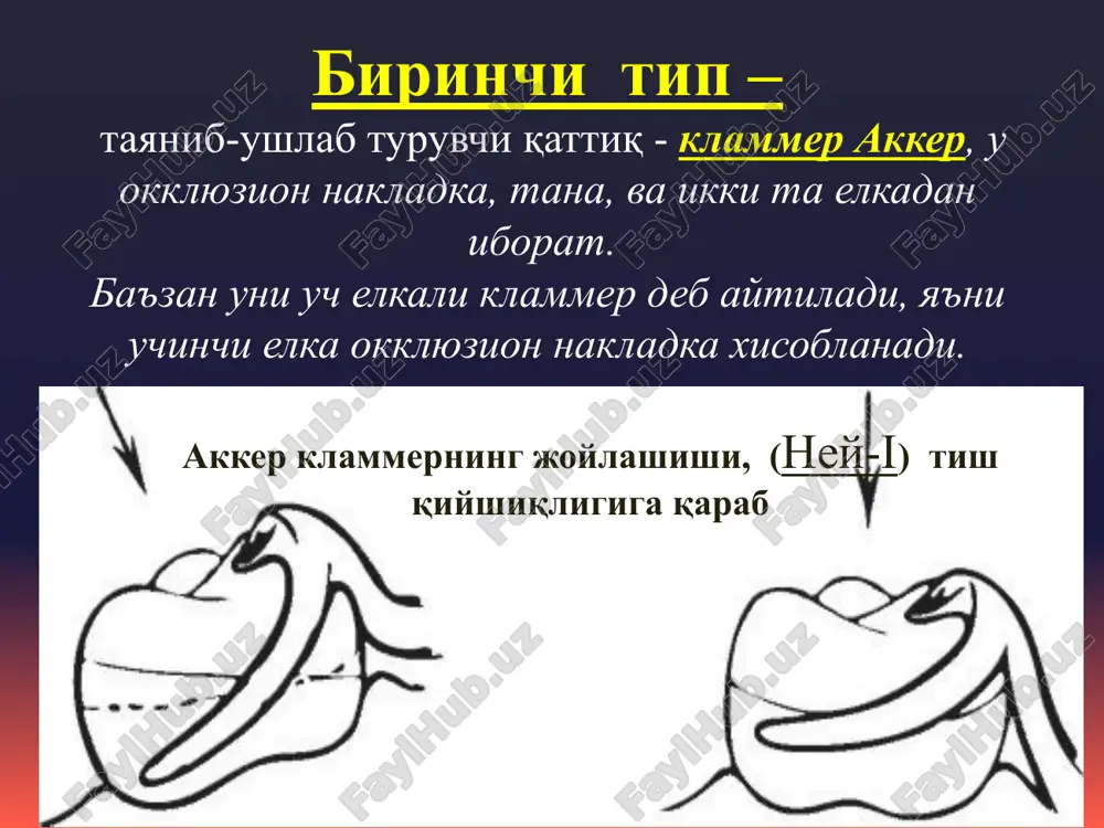 neya «ney» sistemasi bo'yicha klammerlar - Page 3