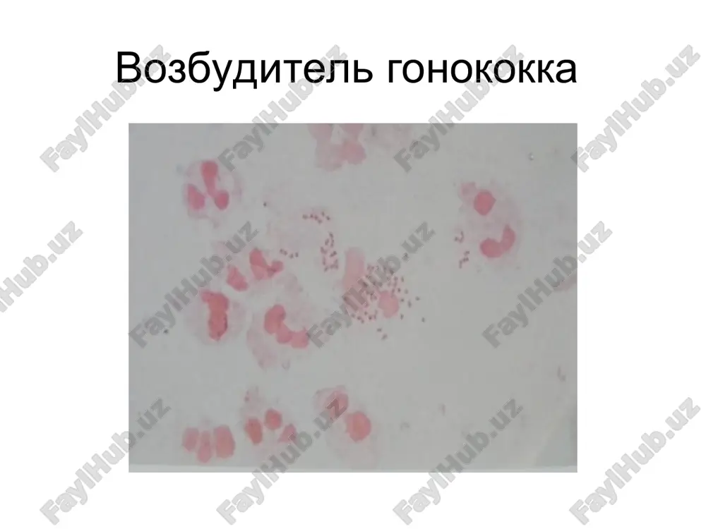 neisseria gonorrhoeae - Page 3
