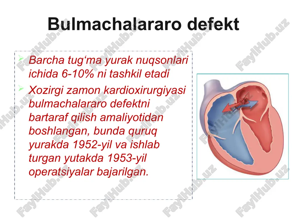 sh uchun transkateter sistemali (amplatzer) okklyuder fallo tetradasi o‘pka arteriyasini torayishi, korinchalar aro tusik nuksoni, aortani o‘ng tomonga siljishi va uni korinchalar aro to’siq nuqsonini ustida joylashishi o‘ng korincha devorining gipertrofiyasi fallo tetradasi fallo tetradasi umrovosti- upka anastomozi (blelok-tausig amaliyoti fallo tetradasida korinchalar aro to’siq nuqsoniga yamoq tikish aorta koarktatsiyasi bosh ogrishi arterial kon bosimining oshishi burindan kon ketishi yurak soxasidagi ogriklar yurak urishi boshda ogirlikni va pulsatsiyanni sezish aorta koarktatsiyasi