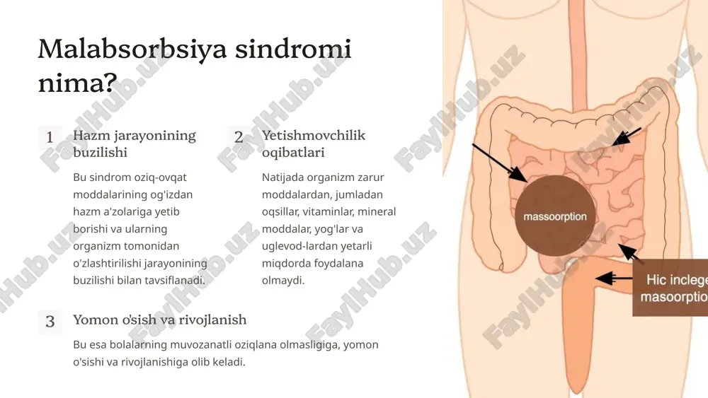 i alomatlari: ozib ketish: kaloriyalar va oziqaviy moddalar yetishmovchiligi natijasida. raxit yoki suyak mo‘rtligi: kalsiy va d vitamini yetishmasligida. anemiya: temir va folatning so‘rilishi buzilganda. soch to‘kilishi va tirnoqlar mo‘rtlashishi. 3. umumiy holat: o‘sish va rivojlanishning kechikishi: bolalar yoshi uchun yetarlicha vazn va bo‘y ololmaydi. charchoq va sustlik: energiya yetishmasligi tufayli. quruq teri va og‘iz burchaklaridagi yoriqlar: a va b vitaminlar yetishmovchiligi bilan bog‘liq. 4. immunitetning zaiflashishi: tez-tez infektsiyalar (masalan, pnevmoniya yoki oshqozon-ichak infeksiyalari). yara va jarohatlarning sekin bitishi. malabsorbsiya sindromini aniqlash uchun diagnostik usullar 1. najas tahlili: yog‘ miqdorini va parazitlarni aniqlash . 2. qon tahlillari: vitaminlar va mineral darajalarini baholashi 3. genetik testlar: kistoz fibroz yoki fermentopatiyalarni aniqlash . 4. ichak biopsiyasi: seliakiya yoki enteropatiyalarni tasdiqlash. 3. qorin bo‘shlig‘i organlarining shikastlanishi jarrohlik aralashuvi: masalan, ichak qismining olib tashlanishi yoki gastroektomiya. qorindagi o‘simtalar: ichaklarning bosilib qolishi va so‘rilish jarayonining buzilishi. malabsorbsiya sindromi sabablari bolalarda malabsorbsiya sindromini diagnostika qilish 1 …
