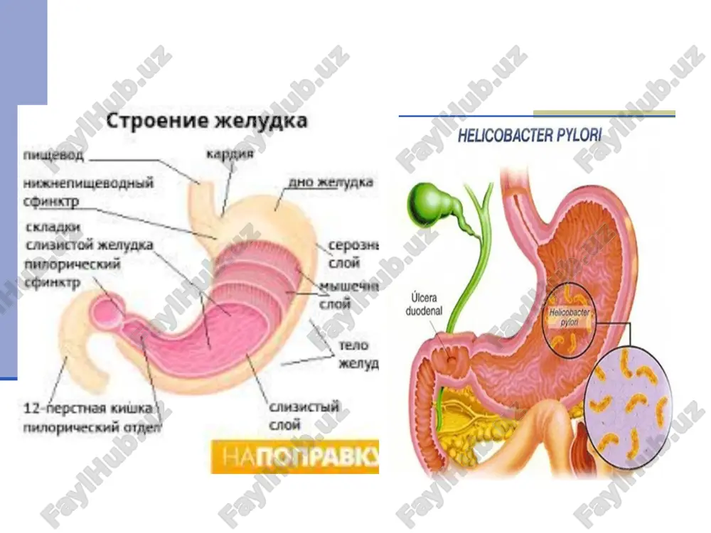 , jig'ildon qaynashi, ko'ngil aynashi, qabziyatga moyillik. xlorid kislotasi sekretsiyasining pasayishi (ko'pincha a turidagi gastrit) og'riq sindromi kuchsiz ifodalangan, epigastral sohadagi simillovchi tarqoq og'riqlar xos. ovqatdan so'ng qorinning yuqori qismida og'irlik va to'lish sezgisi; og'riqlar ovqat sifati va hajmiga bog'liq ravishda paydo bo'ladi va kuchayadi. paypaslaganda epigastral sohada kuchsiz “tarqoq” og'rik. dispeptik sindrom og'riq sindromidan ustun keladi. ovqat bilan kekirish, ko'ngil aynishi, og'izda achchiq his qilish, ishtaha pasayishi, meteorizm, o'zgaruvchan ich kelishi kuzatiladi. og'riqni o'rganish xalqaro assotsiatsiyasi tarifi bo'yicha og'riq – ko'plab kasalliklar belgisi bo'lib, to'qimalarning shikastlanishi yoki ulardagi o'zgarishlar oqibatida noxush, chidash qiyin sezgi (sensor) va emotsional zo'riqishdir og'riq kechishi bo'yicha o'tkir og'riq surunkali og'riq og'riq xarakteri doimiy (simillovchi) og'riq yallig'lanish vaqtida shilliq va shilliq osti kavatning nerv elementlari doimiy tasirlanishi oqibatida rivojlanadi davriy (periodik- vaqt-vaqti bilan, kechasi) og'riq oshqozon shirasi gipersekretsiyasi, privratnik spazmi oqibatida kelib chikadi xurujsimon og'riq sillik mushaklar spastik qisqarishi oqibatida kelib chikadi mavsumiy og'riq ( …