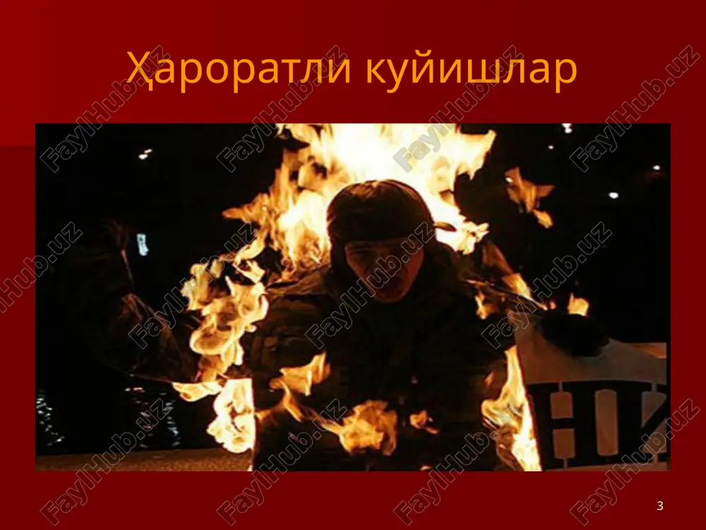 ur kuyish 20 % dan ziyod, bunda: ko'z, quloq, yuz, kaft, oraliq va avrat shikastlangan, shuningdek, nafas yo'llari, elektr tokdan shikastlanish, kombinatsiyalangan va aralash mexanik shikastlar bilan kuzatilgan xolatlarda. kuyish prognoz bemorlar uchun shubxali bo'lib kombustiologiya bo'limlarida davolanishi shart. 22 22 yuzaki kuyish ii daraja. epidermisni shikasti •og'riq •teri giperemiyasi •shish •bulla (qattiq tortilmagan seroz suyuqlik) 23 oraliq yoki chuqur kuyish iiia st. epidermisni va qisman terini shikasti •epidermis deskvamatsiyasi, puffakchalar ostida to'q sariq suyuqlik •yara yuzasi qizg'ish •sezilarli shish 24 iii a – darajali kuyish 25 klinicheskaya kartina 25 iii b - iv darajali kuyish 26 klinicheskaya kartina ojogovogo shoka 26 chuqur kuyish iiib daraja. terini to'liq kuyishi •quruq, qattiq taranglashish •teri oq-qo'ng'ir rangda •sezgi yo'qolgan •to'liq shish 27 chuqur kuyish iv daraja. terining to'liq kuyishi •to'qimani ko'mir tusga kirishi •qon tomirlar koagulyatsisi •suyak sinishlari •kuygan soxa yuzasini to'liq kuyishi. 28 nafas yo'llarini kuyishi 29 nafas yo'llarini kuyishi turli …