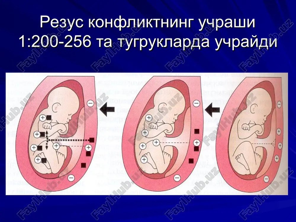 rezus – sensibilizatsiya va homila gemolitik kasalligi - Page 3