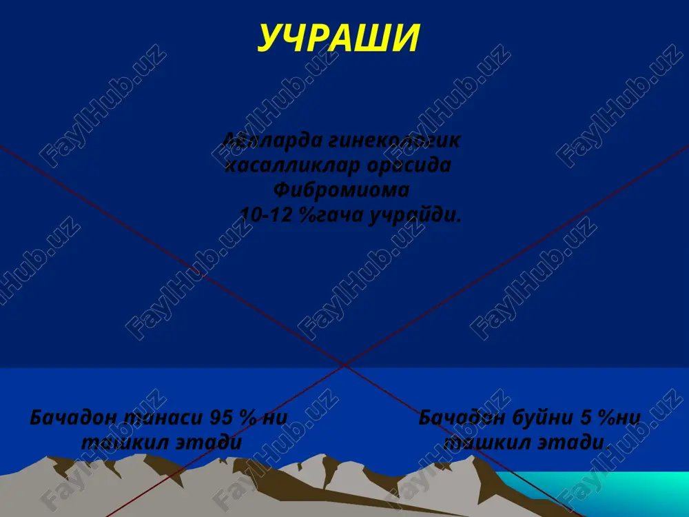 atda kuchli og’riq, ko’pincha qon ketish va tana haroratining ko’tarilishi va boshqa belgilar kuzatiladi 3. shilliq osti qavati miomasining tug’ilish alomati, hatto bachadonning ag’darilishi kuzatilishi mumkin. 4. mioma tugunlarining infeksiyalanishi, yiringlashi. 5. sarkomaga aylanishi. 6. kuchli profuz qon ketishi 7.anemiya (kamqonlik) d i a g n o s t i k a bachadon devorini kirish va morfologik tekshirish exografiya va kompyuter tomografiyasi bachadon ichini zondlash gsg gisteroskopiya uzi bimanual- rektovagina l tekshirish anamn ez gisterografiya:bachadon ichi miomasi formasi va tishli konturlarining uzgarishi. . uzi: miomatoz boylamda uzi: miomatoz boylamda kuptugunli bachadon miomasi differentsial diagnostika: davolash: operativ konservativ – (simptomatik, gormonal) konservativ davolashda kursatma mioma ulchami 12 xaftadan kichik usma kushni organlarni sikmaganda kasalda anemiyaga olib keltiruvchi doimiy kon ketish yuk. medikomentoz davolash: -reproduktiv yoshda kichik o’lchamdagi bachadon miomalarda (5-12) haftalik homiladorlik o’lchamigacha) konservativ terapiyadaulipristal atsetat ( esmiya) yoki tugunlar 3smgacha bo’lganda kombinatsiyalashgan esterogen-gestagen preparatlari (novinet, lindinet,laktinet) qo’llanilib ular gonadotrop gormonlar …