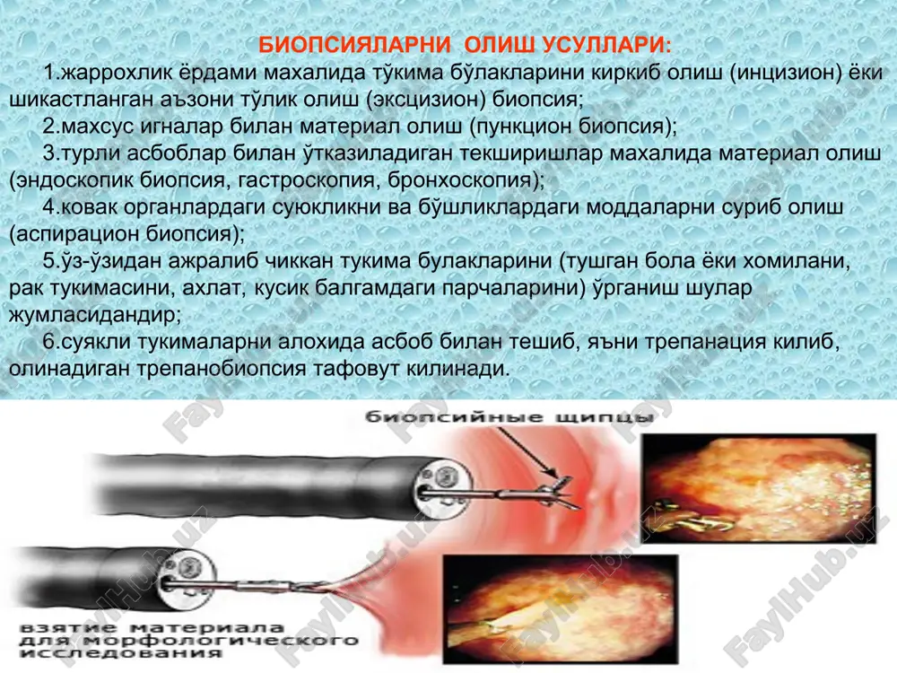 gan va tamom bulgan sana, xayz buzilishining tabiati, kon ketish sanasi) klinik tashxis (diagnoz): __________________________________________________________________________ davolovchi vrach familiyasi: _________________________________________________ imzo: kora kogoz orkali ikki nusxada tulgaziladi uzbekiston respublikasi uz.rssv formasining xos rakami 021 soglikni saklash vazirligi tibbiy xujjat formasi 014/x-1 __________________ 1992 yil 16 aprelda uz.rssvning 231-sonli (muassasining nomi) buyrugi bilan tasdiklangan. patologo-gistologik tadkikot uchun yullanma tekshirish uchun bachadon shillik pardasidan (bachadon buyni yulidan) kirindi bemor ______________________________________ 3. yoshi _________da (familiyasi, ismi – sharifi) kasallik tarixi №____________ bulim _________ xona №_____ klinik tashxisi:__________________________________________________________ anemnestik ma'lumotlari: _________________________________________________________________________ _________________________________________________________________________ 1.xayz davri: xar _____________ xaftada ______________________kundan, 2.oxirgi normal xayz ____________da boshlandi ________________da tugadi. 3.xayz funktsiyasi buzilishining tabiati __________________________________ 4.kon ketayotgan bulsa – boshlangan kuni (xayz paytida, undan oldinrok, undan keyin) __________________________________________________________________________ 5.xayz tuxtab yoki kelmay kolgan bulsa – kanchadan beri _________________________ 6.agar tekshirish utkazilgan bulsa, oldingi gistologik tekshirishning ma'lumotlari _________________________________________________________________________ aloxida muloxazalar________________________________________________________ __________________________________________________________________________ tekshirish uchun material olingan _______________ junatilgan __________________ material yullagan shifokorning …