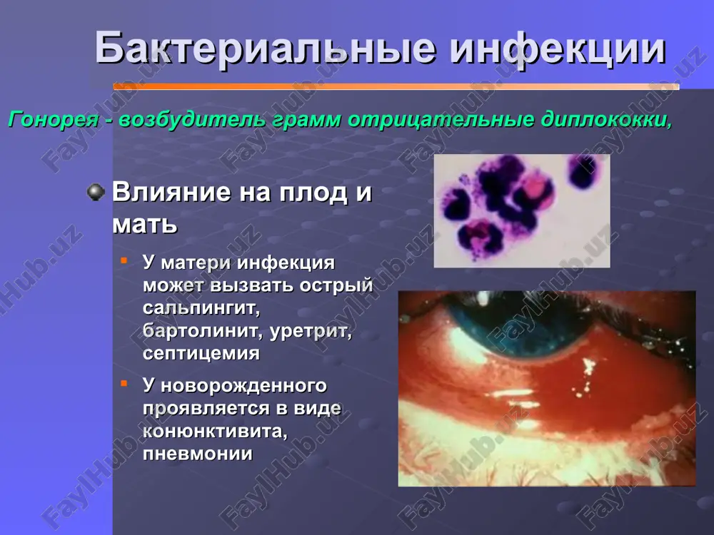ayotsya na vsyu jizn, esli immuniteta net, neobxodimo provodit vaktsinatsiyu vetryanka – * virusnie infektsii vliyanie na plod i mat u materi pervichnaya infektsiya proyavlyaetsya v vide vozikulyoznix i pustulyoznix visipaniy na polovix organax, eti povrejdeniya boleznenni i mogut oslojnitsya limfadenopatiey. proyavleniya zabolevaniya gasnut v techenie 3-5 dney, vozmojni povtornie vspishki zabolevaniya plod ochen redko infitsiruetsya vovremya pervichnoy infektsii, no esli virus popadaet cherez platsentu, proisxodit silnoe narusheniya razvitiya ploda v vide mikrotsefalii i otstalosti, plod nezashishen materinskimi antitelami vo vremya vtorichnoy infektsii plod zarajaetsya v protsesse rodov, zabolevanie proyavlyaetsya v vid povrejdeniy glaz, koji, no nikogda ne tronuta tsns gerpes 2. tip – stz, 0,5-1% jenshin vo vremya beremennosti aktivniy gerpes, no vozmojna reaktivatsiya virus daje pri stoykom immunitete * virusnie infektsii klinicheskie proyavleniya gerpes virusa * virusnie infektsii diagnoz tipichnie klinicheskie proyavleniya, posev virusa, izmeneiya v titre spetsificheskix igm i igg lechenie materi - atsiklovir 200mg x5 v …