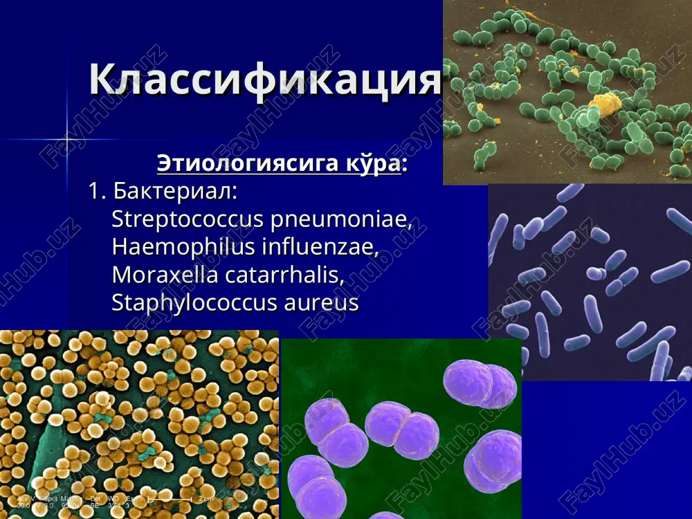 jarayon ko'rinishida rivojlanadi, o'pka to'qimasining emirilishi, abstsess hosil bo'lishi kuzatiladi. immunodefetsit holatlaridagi pnevmoniya qo'zg'atuvchilari: viruslar (gerpes, tsitomegalovirus), grammusbat va grammanfiy bakteriyalar, tuberkulez mikobakteriyalari, pnevmotsistalar, zamburug'lar. klinikasi immunodefetsit holatlaridagi pnevmoniya o'tkir va surunkali mielo- va limfoproliferativ oiv kasalliklar bor bemorlarda rivojlanadi. ko'pincha atipik klinika bilan kechganligi uchun tashxis qo'yish qiyinchilik tug'diradi. kasallik og'irlik darajasi va o'lim xavfini aniqlash mezonlari (curb-65) es hushning buzilishi (confusion) plazmadagi mochevina kontsentratsiyasi 7 mmol/l va undan yuqori (urea) nafas soni > 30 v minutiga (respiratory rate) qon bosimi - ↓ 90mm sim.ust. – sist. va ↓60 mm sim.ust. – diast (blood pressure) 5. yosh ≥ 65. kasallik og'irlik darajasi, o'lim xavfini aniqlash va davolash taktikasini aniqlash mezonlari (curb-65) ballar o'lim % xavf darajasi taktika 0 0,6% past ambulator davolash 1 2,7% past ambulator davolash 2 6,8% o'rta shifokor xoxishiga ko'ra 3 14,8% o'rta og'ir gospitalizatsiya 4-5 27,8% og'ir intensiv terapiya diagnostika 1. umumiy qon tahlili: leykotsitoz …
