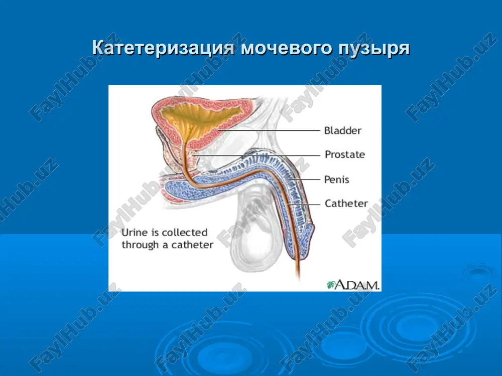 endoskopicheskaya urologiya - Page 3