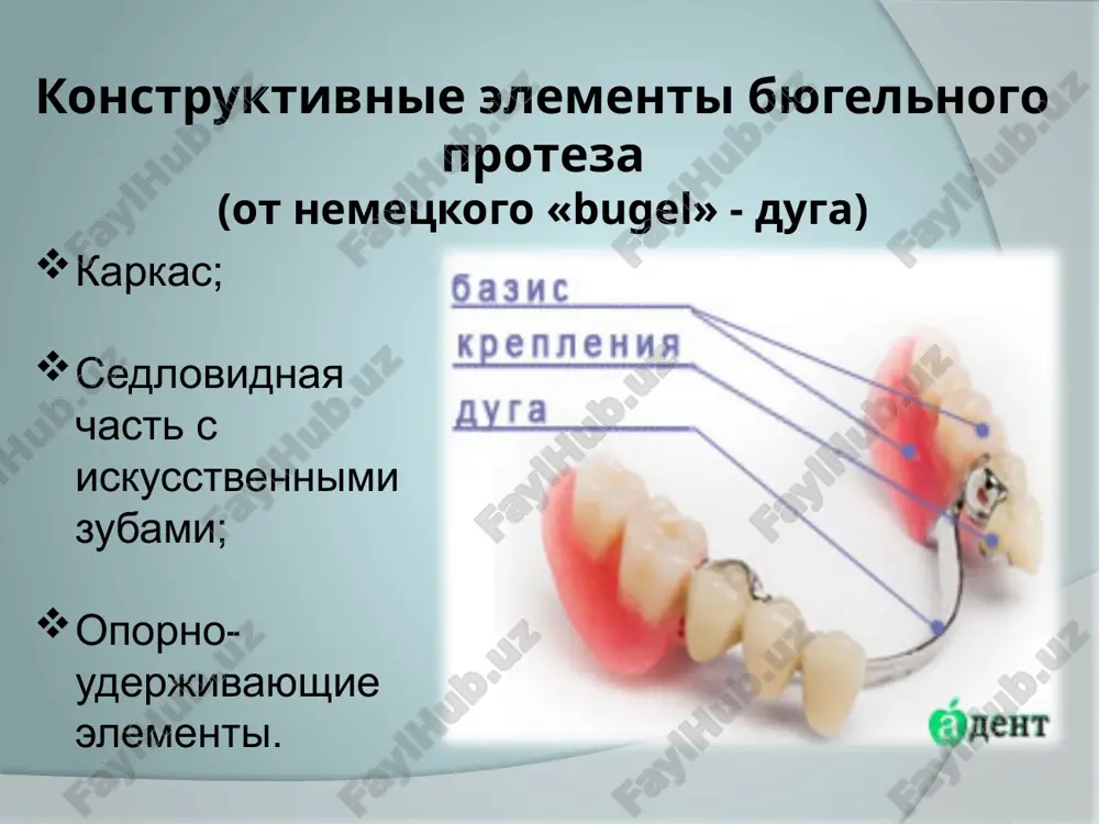 zubov i ne doxodit do dna polosti rta na 2-3 mm. na nijney chelyusti ona otstoit ot slizistoy obolochki na 1-1.2 i zavisit ot napravleniya yazichnoy stenki ag v vertikalnoy ploskosti. pri pogrujenii duga ne doljna soprikasatsya s podlejashimi tkanyami i travmirovat uzdechku. shirina nijnechelyustnoy dugi ne doljna bit menee 3mm, tolshina – 1.5mm (sosnin g.p.). po dannim kopeykina v.n. duga proteza na nijney chelyusti doljna otstoyat ot slizistoy obolochki neravnomerno: u verxnego kraya na 0.5-0.6 mm, u nijnego ne menee chem na 1 mm. duga na nijney chelyusti izgotovlenie lingvalnoy dugi inogda bivaet zatrudneno ili nevozmojno. primenenie ix protivopokazano pri: otsutstvii mesta dlya dugi; dvuxstoronney konvergentsii premolyarov. znachitelnom naklone alveolyarnogo otrostka kperedi (perzashkevich l.m. 1974 g.). v takix sluchayax pokazano primenenie lingvalnoy plastinki ili vestibulyarnoy dugi. lingvalnaya plastinka pokrivaet oralnuyu poverxnost estestvennix zubov ili alveolyarnix otrostkov ot linii naibolshego iskrivleniya ego skata do granitsi podvijnoy slizistoy obolochki. vestibulyarnie dugi …