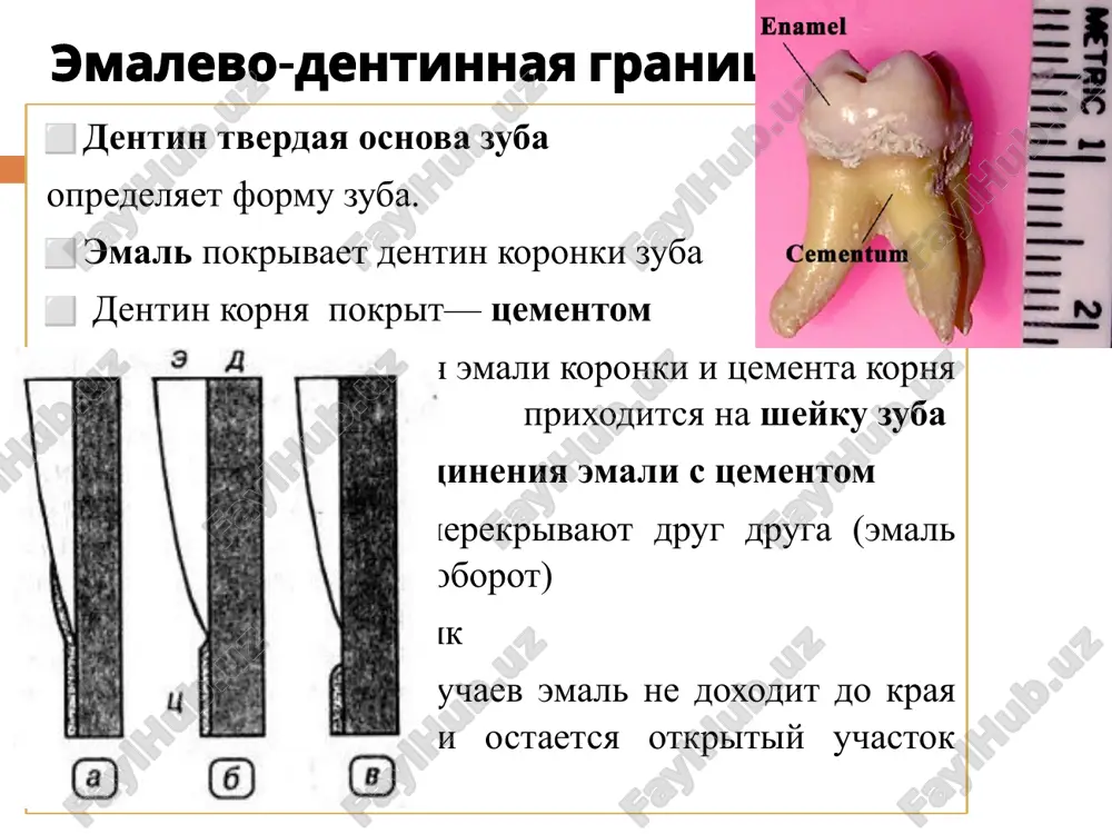 eti, niti kotoroy raspolagayutsya mejdu kristallami. prizmi xarakterizuyutsya poperechnoy ischerchennostyu, obrazovannoy cheredovaniem svetlix i tyomnix polos s intervalami v 4 mkm, chto sootvetstvuet sutochnoy periodichnosti formirovaniya emali (linii rettsiusa) polosi rettsiusa mojno razlichit pod svetovim mikroskopom. oni obrazuyutsya v rezultate periodicheskix faz pokoya ameloblastov v period obrazovaniya emali, i vneshne sxodni s protsessom obrazovaniya godichnix kolets dereva eto preimushestvenno gipomineralizovannie uchastki okrashennie v jyolto-korichneviy tsvet imeyut vid simmetrichnix arok, idushix koso ot poverxnosti emali k dentino-emalevoy granitse napravlennie na prisheechnom uchastke k poverxnosti emali na koronkovom uchastke, vozle dentinnogo yadra, oni obrazuyut polukrug lini rettsiusa 15 1 — emal 2 — kosie temnie linii — emalevie poloski (linii rettsiusa) 3 — chereduyushiesya emalevie poloski (polosi shregera) 4 — koronka zuba 5 — dentin 6 — dentinnie kanaltsi 7 — sheyka zuba 8 — polost zuba 9 — dentin 10 — koren zuba 11 — tsement 12 — kanal kornya zuba …