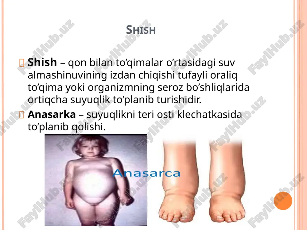 uichraydiva keyinchalik skleroz boshlanadi. shishlarning klinik ahamiyati ularning paydo bo’lishi mexanizmiga, olgan joyiga, qanchalik tarqalganligiga bog’liq. ayniqsa ular cheklangan bo’lsa, organizm hayot faoliyatini izdan chiqarmaydi. plevra bo’shlig’ida suyuqlik to’planib qolganda ko’krak faoliyatini buzadi, gidroperikardium yurak to’xtab qolishiga olib kelishi mumkin. degidratatsiya degidratatsiya – eksikoz(suv qochishi suvsizlanish) to’qima suyuqligi miqdorining kamayib ketishiga aloqador bo’lib, qonda suv yo’qolishi (angidermiya) bilan birga davom etadi degidratatsiyaga quyidagi omillar sabab bolishi mumkin psixozlar, komatozholatlardaorganizmga tushadigan suv miqdorinig kamayib ketishi. badan terisi , o’pka, buyrak, ichak orqali suyuqlik yo’qotilishi buyraklardan suyuqlikning ko’plab ajralishi, poliuriya boshlanishi. shok shok- to’qimalarning qon bilan bilan ta’minlanishi, ulardagi almashinuv jarayonlari darajasidagi mutlaqo to’g’ri kelmaydigan darajada keskin pasayib ketishi bilan ta’riflanadigan patologik jarayon. etiologiyasi va patogenezi. shokning quyidagi turlari tafovut etiladi: travmatik shok kardiogen shok gemotransfuzion shok infeksion – toksik shok anafilaktik shok gipovolemik shok neyrogen shok shokning bosqichlari. shok tobora zo'rayib boradigan, o'limga olib kelishi mumkin bo'lgan patologik jarayon jumlasiga kiradi. …
