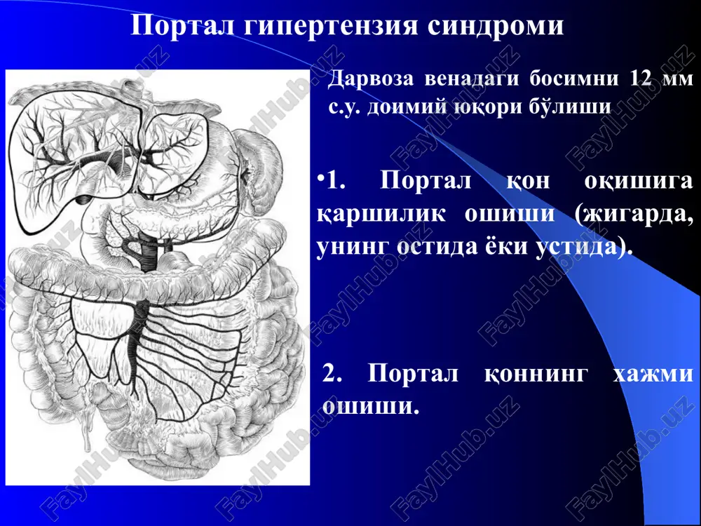 da va qizilo'ngach vvk pik tsirrozi.kattalshgan jigar. kengaygan pkv dekompensatsiya bosqichi kompyuter tomografiyasi splenorenal shuntlar jigar arteriyasining ilonsimonligi jigar tsirrozidagi texnetsiy-99 bilan stsintigrafiya radionuklid tekshiruv usullari darvoza venasining trombozidan so'ng rivojlangan kollateral tarmoklar magnit-rezonans tomografiyasi arteriovenoz fistula angiografik tekshiruvi sxemasi angiografik tekshiruv usullar tseliakografiya pgni dekompensatsiya bosqichidagi tseliakografiyasi angiografik tekshiruv usullari splenoportografiya. bilvosita portografiya angiografik tekshiruv usullari teri orqali jigar orqali portografiya. darvoza venasining trombozi kengaygan gastroezofageal shuntlar kengaygan splenorenal shuntlar angiografik tekshiruv usullar pastki kavagrafiya va gepatovenografiya pastki kavak vena stenozi jigar venasining stenozi pastki kavak venaning okklyuziyasi jigar venasining okklyuziyasi instrumental tekshiruv usullari. biopsiya. davolash usullari konservativ (terapevtik) xirurgik usullar endovaskulyar usullar portal gipertenziyaning davolash usullari. tasnifi endoskopik usullar aralash usullar portal gipertenziyaning jarroxlik davolashning vazifalari: 1. poptal sistemani dekomppessiyasi 2. portal sistemani boshqa qon ketish extimoli bor nozik sistemalardan ajratish (gastpoezofageal venoz tarmog'idan) 3. astsit bilan kurashish jarrohlik davolash usullar a.s.talma operatsiyasi omentonefropeksiya splenektomiya 1.portal sistemaga qon …