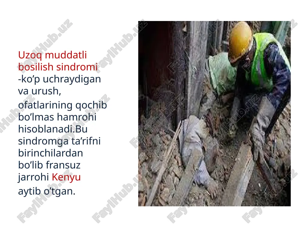 so’rilib ketishiga yordam beradi. keyin jgutni yechish va giperkalimiya, to‘qimalarni gipoksiyaga sezuvchanligini kamaytirish maqsadida sovuq (muz, qor, suv) qomlash kerak. keyin qo ‘l-oyoqlar immobilizatsiyasi, o g 'riq qoldiruvchilar, antibiotiklar qilish kerak. vrachgacha yordam. birinchi tibbiy yordam hajmi kengaytiriladi. agar qo‘l yoki oyoqlar siqib boglanmagan bo’lsa boglanadi va sovutish choralari qo’llanadi, yurak-qon tomir va og'riqsizlantiruvchi vositalar qo’llanadi.ishqorli eritmalar ichishga beriladi. birinchi vrachlik yordamiga tezlikda ko'chiriladi birinchi vrachlik yordami (brtp). saralash vaqtida 2 guruh umbsdan jabrlanganlar ajraiiladi: i guruh: umbsning yengil va o'rta darajalari bilan jabrlanganlar.tibbiy yordam saralash maydonida ko'rsatiladi. bunda 0,5 ml qoqsholga qarshi anatoksin, 100000 yed.penitsillin, 1% li 2 ml prom edol eritmasi yuboriladi, transport immobilizatsiyasi kuchaytiriladi, ishqorli suyuqliklar ichishga beriladi, ixtisoslashtirilgan vrachlik yordami etapiga yuboriladi. ii guruh: umbsning og‘ir formasidagi jabrlanganlar. tibbiy yordam bog’lov xonasida ko‘rsatiladi. ezilgan qo’l yoki oyoqqa novokainning 0,25% li 400 -500 ml iliq eritmasi bilan futlyar novokain blokada qilinadi. vishnevskiy bo‘yicha ikki tomonlama paranefral blokada …