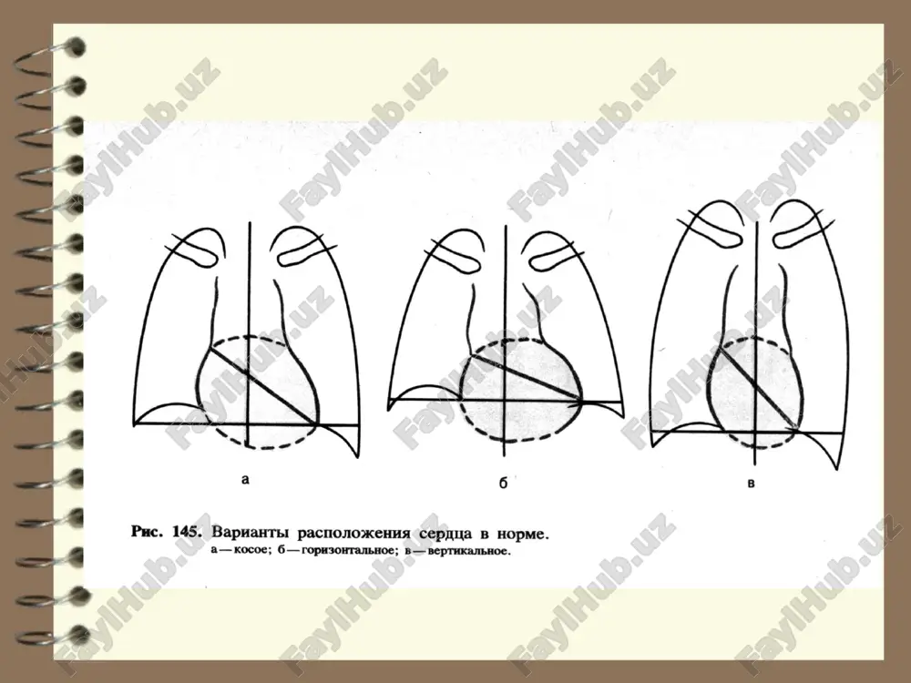 ng kichik shoxlari trombemboliyasida o'zgarishlarning birinchi varianti.o'pkaning ildizi kengaygan, ko'pincha aniq tashqi konturga ega, undan radiarik ravishda cho'zilgan arterial tomirlar yo'q, ko'krak qafasining lateral qismlarida o'pka naqshlari "xaotik" xarakterga ega bo'ladi. o'pka arteriyasining kichik shoxlari trombemboliyasidagi o'zgarishlarning ikkinchi varianti.ta'sir qilingan hududda o'pka naqshlari kuchayadi, tomirlar bo'ylab kattalashadi va atrofga qarab kuzatiladi, o'pkaning ildizi kengayadi. qon tomirlarini o'rganish bo'yin tomirlarining mr angiogrammasi normaldir. aorta yoyining yuqori qismi, karotid tizimi, subklavian arteriyalarning proksimal qismlari, umurtqali, qalqonsimon, chuqur bo'yin arteriyalarining magistrallari, bo'yin tomirlarining distal qismlari ko'rinadi o'ng vertebral arteriyaning tasviri yo'q (gipoplaziya). ok-chap vertebral arteriya o'ng vertebral arteriyaning konsentrik torayishi, o'ng tomonda c6-c7 diskining chiqishi va shu darajada unkovertebral artikulyatsiya artrozi tufayli o'tkir emboliya. agar oz miqdordagi kollaterallar mavjud bo'lsa, qarama-qarshi tomir lümeninin aniq tanaffusi ko'rinadi aterosklerozni yo'q qilish. tashqi yonbosh arteriyasi boshlanganidan so'ng darhol o'ng tomonda pastki oyoq tomirlariga shikast etkazish. kasalxona shifokorlar maslahat berishadi koronarografiya koronarografiya-bu koronar arteriya torayishining tabiati, joyi …