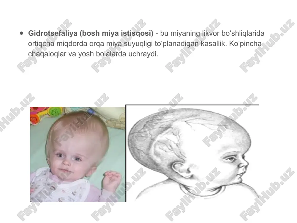bosh miya kasalliklari nur tashxisi - Page 3