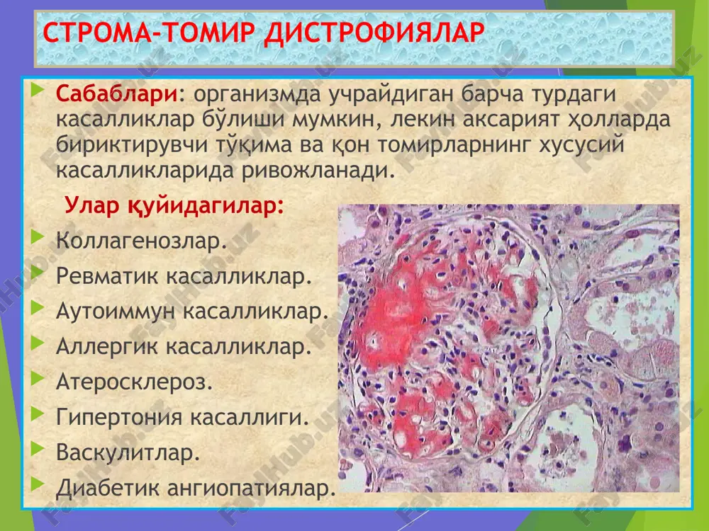 к касалликларда. морфологияси: макро – томир шишасимон найга айланади; микро – эндотелий остида гомоген, қизил модда тўпланган, томир бўшлиғи торайиб, ёпилган ҳолатда. сосудистый гиалиноз, накопление гиалина в субэндотелиальной зоне за счет повреждения эндотелия, базальной мембраны и мышечного слоя.. причины: гипертонич. болезнь, гипертензии, сахарный диабет. локализация: почка, головной мозг, сетчатка глаз, панкреас, кожа. виды: простой –гипертонич. болезнь; липогиалин – диабетич. микроангиопатия, сложный гиалин – иммунопатологические болезни. морфология: макро – артерия превращается в стекловидные трубочки; микро – в субэндотелиальной зоне гомогенное вещество –гиалин, просвет сужен или закрыт. бириктирувчи тўқима гиалинози, бу – чандиқ бириктирувчи тўқимада коллаген толалар фибриноид бўкиши ва деструкцияси, унга плазма оқсиллари ва полисахаридларнинг бирикиши, гиалин пайдо бўлиши. сабаблари: чандиқлар, склероз, келоид, суринкали яра, ўсмалар. макро: склерозга учраган тўқима қаттиқ, оқиш, ярим-ялтироқ кўринишда. микро: бириктирувчи тўқима толалари фибриллярлигини йўқотган, бир-бири билан қўшилишиб, қизил рангли гомоген гиалин моддасига айланган. гиалиноз соединительной ткани, это – фибриноидное набухание и деструкция коллагеновқх волокон в …