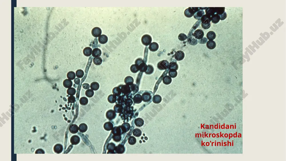 kandidoz - Page 3
