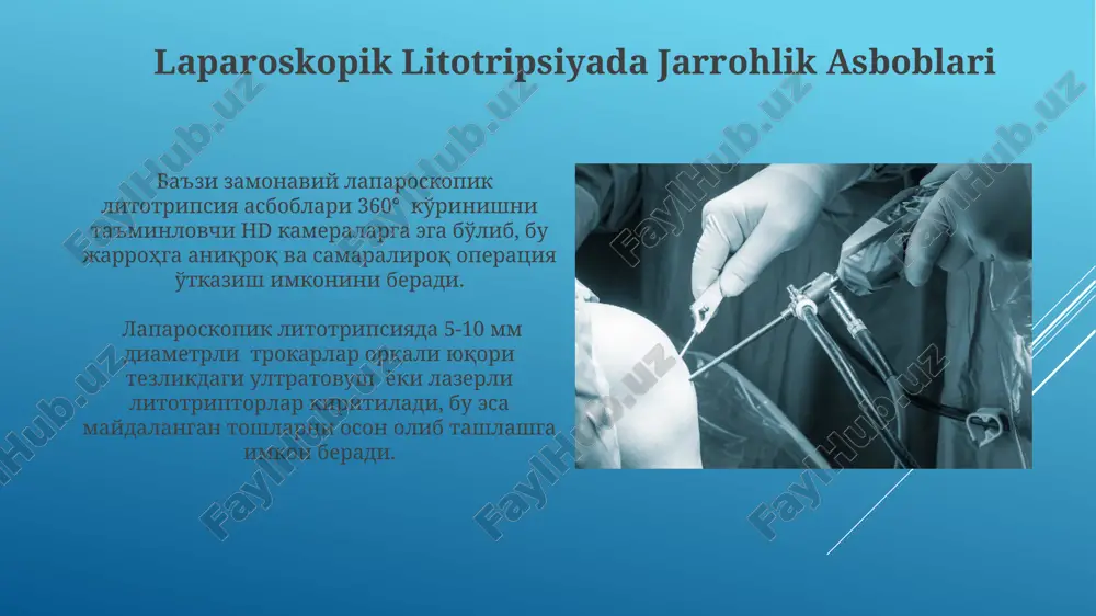 n tavsiflanadi, bu bemorlarning tezroq tiklanishiga olib keladi. kelajakdagi tendentsiyalar va tadqiqotlar lazer va ultratovush litotripsiyasi texnologiyalarining kombinatsiyasi bo'yicha klinik sinovlar natijalari 2024 yilda nashr etilib, buyrak toshlarini maydalash samaradorligini 20% ga oshirishini ko'rsatdi. minimal invaziv texnologiyalarni rivojlantirish, masalan, 5 mm dan kam diametrli laparoskopik asboblarni qo'llash, jarrohlik asoratlari sonini 15% ga kamaytirishga qaratilgan. buyrak toshlarini maydalash usullari laparoskopik litotripsiya jarrohlik maydonini yaxshi ko'rish imkonini beradi, bu esa jarrohga 1-2 mm gacha bo'lgan mayda toshlarni ham aniq olib tashlashga yordam beradi va asoratlar xavfini pasaytiradi. buyrak toshlarini maydalashning laparoskopik usuli, 5 mm dan kam diametrli toshlar uchun minimal invaziv yondashuv bo'lib, 90% dan ortiq muvaffaqiyat ko'rsatkichiga ega. asoratlar va ularning oldini olish qon ketishi, infektsiya va ichak shikastlanishi laparoskopik litotripsiyaning eng ko'p uchraydigan asoratlaridan bo'lib, ularning oldini olish uchun ehtiyotkorlik bilan jarrohlik amalga oshirish va postoperatsion davrni to'g'ri nazorat qilish zarur. laparoskopik litotripsiyada asoratlarning 5-10% gacha uchrashi mumkin, bu esa …