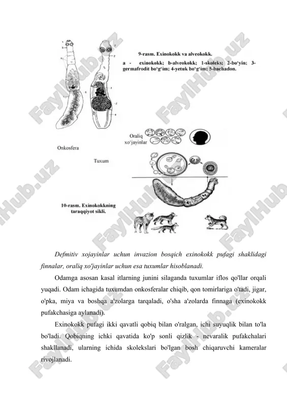 eksiyalash, sanitariya - oqartuv ishlarni yo'lga qo'yish, orqali oldini olish choralari amalga oshiriladi. serbar tasmasimon chuvalchang (diphyllobothrium latum) – diffilobotrioz qo'zg'atuvchisi. parazitning xo'jayinda joylashishi. yetuk shakli odam va go'shtkho'r hayvonlarning ingichka ichagida parazitlik qiladi. geografik tarqalishi. tabiiy manbali kasalliklar guruhiga kiradi. difillobotrioz manbalari sharqiy sibirning buyuk daryolari havzalarda hisoblanadi. morfologiyasi. odam parazit gijjalari orasida eng yirigidir. uzunligi 20 metrgacha yetadi. skoleksda so'rg'ichlari, ilmoqchalari yo'q, ikkita botriyalari bo'lib, ular yordamida ichak devoriga yopishadi. bo'g'imlari teniidlamikiga qaraganda ancha keng. bachadoni sirtmoqlar hosil qiladi, bachadonda chiqarish teshigi mavjudligi sababli yon shoxchalarini hosil qilmaydi. sarikdon bo'g'imning yon tomonlariga joylashadi. jinsiy kloakasi yonida emas, bo'g'im o'rtasida joylashgan (rasm). hayot sikli. definitiv xo'jayini odam va go'shtxo'r hayvonlar (itlar, mushuklar, tulkilar, shimol tulkilari va boshqalar) hisoblanadi. birinchi oraliq xo'jajyni - tuban qisqichbaqasimonlar (siklop) ikkinchi oraliq xo'jayini esa -baliqlar hisoblanadi. tuxumlar axlat bilan suvga tushganidan taxminan bir oydan so'ng korasidiylar (kiprikchalar bilan qoplangan va o'n juft ilmoqlari bo'lgan) …