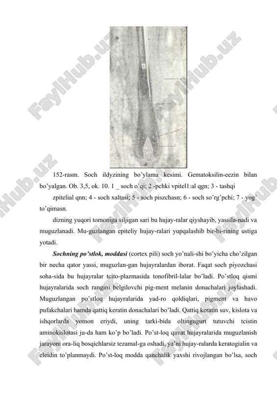 muguzlangan bo’-ladi. soch ildizi teri sathiga nisbatan qiyshiq yo’naladi va s o ch piyozchasini (bulbus pili) hosil qiladi. soch piyozchasiga tagidan botib ; kirgan soch so’rg’ichi (papilla pili) siyrak tolali shakllanmagan biriktiruvchi to’qimadan iborat. bu to’qi-ma qon tomirlar va nerv oxirlariga boy. so’rg’ich hisobiga soch oziqlanadi. so’rg’ichni qoplab turgan soch piyozchasining epiteliy-si kambial hujayralar hisoblanib, ular hisobiga soch o’sadi. soch so’rg’ichining ustida joylashgan hujayralar sochning mag’iz va po’stloq moddasini, eng pastki qismlarini qoplagan kambial hujayralar esa soch kutikulasini va soch ichki epitelial qinini hosil qiladi. soch piyozchasi hujayralari soch so’rg’ichidan, ya’ni oziqlantiruvchi manbadan uzoqlashgan sari muguzlanish protces-siga uchraydi. shuning natijasida hujayralar cho’zinchoq muguz tanachalarga aylanib boradi. muguzlanish jarayoni sochning po’stloq va kutikula qismida jadal ketadi. soch rangi sochning po’stloq qismini hosil qiluvchi hujayralardagi pigment moddasining miqdoriga bog’liq. pigment donachalari soch ildi-zining yuqori qismidagi hujayralarda ham saqlanadi. sochning oqarishi pigment hosil bo’lishining susayishi va shuning bilan bir qatorda soch ildizining muguz …