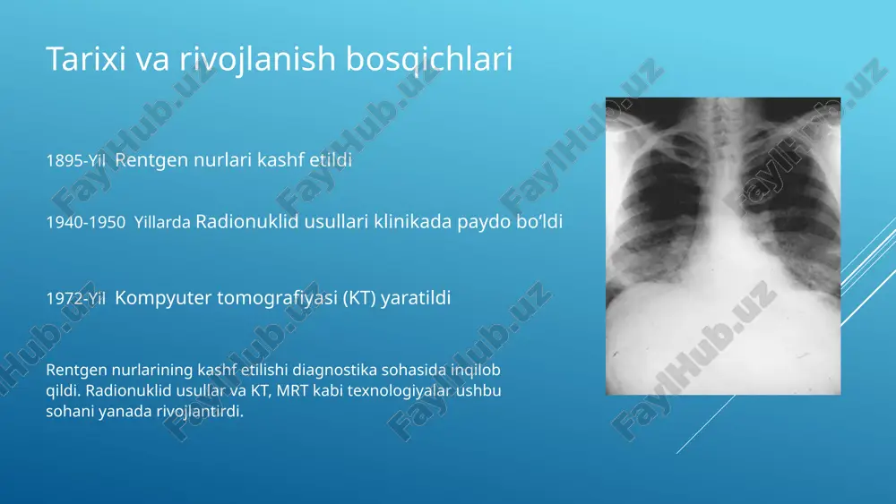 diodiagnostika) maqsad: o‘smalar, insult, travma, epilepsiya, altsgeymer kasalligi va boshqa nevrologik holatlarni aniqlash. asosiy usullar: kt (kompyuter tomografiyasi) travmalar, ichki qon ketishlar, yallig‘lanish va insultning erta bosqichida asosiy usul. tez yordam sharoitida tezkor. mrt miya tuzilmalarini yuqori aniqlikda ko‘rsatadi. shishlar, demiyelinizatsion kasalliklar (ms), insultdan keyingi o‘zgarishlar, meningit. fmri – funksional miya faolligini o‘lchaydi. pet / spect metabolik va funksional tahlil. epilepsiya o‘choqlarini aniqlash, altsgeymer, parkinson, va boshqa neurodegenerativ kasalliklar. pet – glukoza metabolizmini tahlil qiladi (¹⁸f-fdg). miya diagnostikasi (nevrologik diagnostika) nur tashxis uskunalari va texnologiyalari bu qurilma radioaktiv izotoplar yordamida bemorning ichki organlarini ko‘rish uchun ishlatiladi. bemor organizmiga maxsus radiofarmatsevtik preparat yuboriladi (masalan, teknetsiy-99m).ushbu izotopdan chiqqan gamma nurlari bemor tanasidan o‘tayotganda gamma kamera tomonidan aniqlanadi. kamera ichidagi scintillatsion kristall (odatda nai(tl)) gamma nurlarini yorug‘lik impulsiga aylantiradi. yorug‘lik impulsi fotoko‘paytirgichlar yordamida signalga aylantiriladi va tasvirga aylantiriladi. qo‘llanilishi: yurak, buyrak, qalqonsimon bez, suyaklar, jigarda qon oqimi yoki organ faoliyatini baholashda ishlatiladi. gamma …