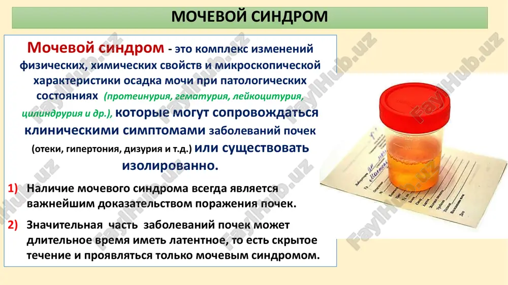 vidi: 1) terminalnaya – krov prisutstvuet tolko v posledney portsii mochi; 2) initsialnaya – krov obnarujivaetsya tolko v pervoy portsii mochi; 3) totalnaya – portsiya videlyaemoy mochi vsya okrashena v krasniy/rozoviy tsvet. vnepochechnaya gematuriya prichina istochnik gematurii kamni 1) mochetochniki 2) mochevoy puzir opuxoli 1) mochevie puti 2) adenokartsinoma predstatelnoy jelezi 3) dobrokachestvennaya giperplaziya predstatelnoy jelezi infektsii i parazitarnie invazii 1) ostriy tsistit, prostatit, uretrit, vizvanniy bakteriyami ili chlamydia trachomatis 2) tuberkulyoz, shistosomoz mochevix putey lekarstva 1) tsiklofosfamid (gemorragicheskiy tsistit) 2) geparin natriya 3) varfarin travmi 1) inorodnoe telo mochevix putey 2) kontuzii mochevix putey 3) dlitelnaya xodba/beg pochechnaya klubochkovaya gematuriya gruppa primeri zabolevaniy pervichnie porajeniya klubochkov pochek 1) ostriy postinfektsionniy glomerulonefrit 2) mezangiokapillyarniy glomerulonefrit 3) bistroprogressiruyushiy glomerulonefrit 4) fibrillyarniy glomerulonefrit vtorichnie porajeniya (pri sistemnix zabolevaniyax) 1) purpura shyonleyna-genoxa 2) sistemnaya krasnaya volchanka 3) sindrom gudpaschera 4) sistemnie vaskuliti (osobenno anca-assotsiirovannie) nasledstvennie/se meynie 1) bolezn tonkix bazalnix membran pochechnix klubochkov …