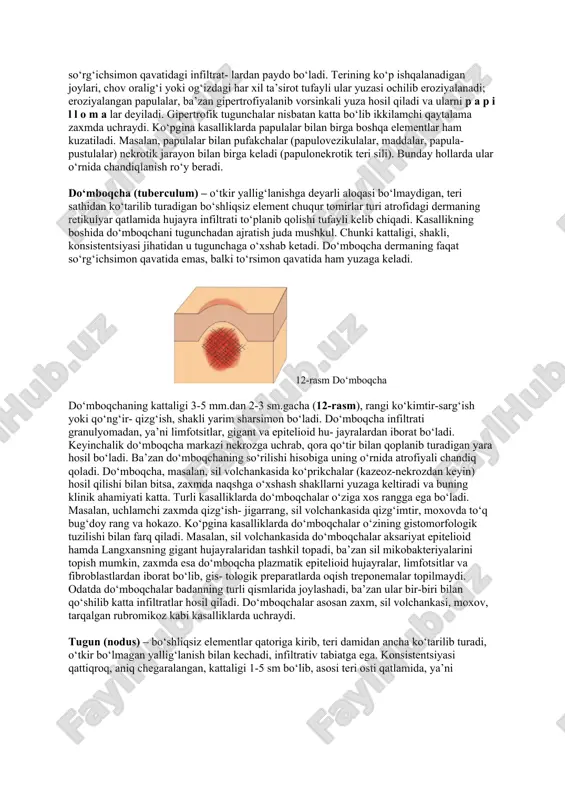 yorilganda qon quyilishi) ajratiladi. gemorragik dog‘lar allergik vaskulitda, organizmda s vitamin yetishmaganda, shuningdek, tif, qizilcha va boshqa kasalliklarda kuzatiladi. pigmentli dog‘lar epidermisningbazal qavatida melaninning ko‘p hosil bo‘lishi (giperpigmentatsiya) yoki taqchilligi (gipopigmentatsiya) tufayli paydo bo‘ladi. pigmentli dog‘lar tug‘ma (hollar, albinizm) yoki hayotda or- ttirilgan (xloazma, vitiligo) ko‘rinishida bo‘lishi mumkin. gi- perpigmentli dog‘lar ichida quyosh nuri ta’sirida bahorda yuz terisiga tushadigan jigarrang dog‘lar, ayniqsa, ko‘p uchraydi. katta giperpigmentli dog‘lar addison kasalligida kuzatiladi. kattaligi 0,5-1,0 sm keladigan giperpigmentli dog‘lar l e n t i g o deyiladi. bunday dog‘lar yuzasi giperkeratozlanib turadi. mayda depigmentli dog‘lar l e y k o d e r m a deyiladi. leykoderma, ayniqsa, atrofi jigarrang bo‘lgan dog‘lar orasida oqarib yaxshi ko‘rinadi. chin leykoderma ikkilamchi qaytalama zaxmda, soxta yoki ikkilamchi leykoderma esa tangachali va rang- barang temiratkida kuzatiladi. butun badan terisida, shuningdek, qosh, kiprik va sochlarda pigment bo‘lmasligi albinizm deyiladi. albinizm tug‘ma bo‘ladi. teri ichida erimaydigan bo‘yoqlar hisobiga rangning …