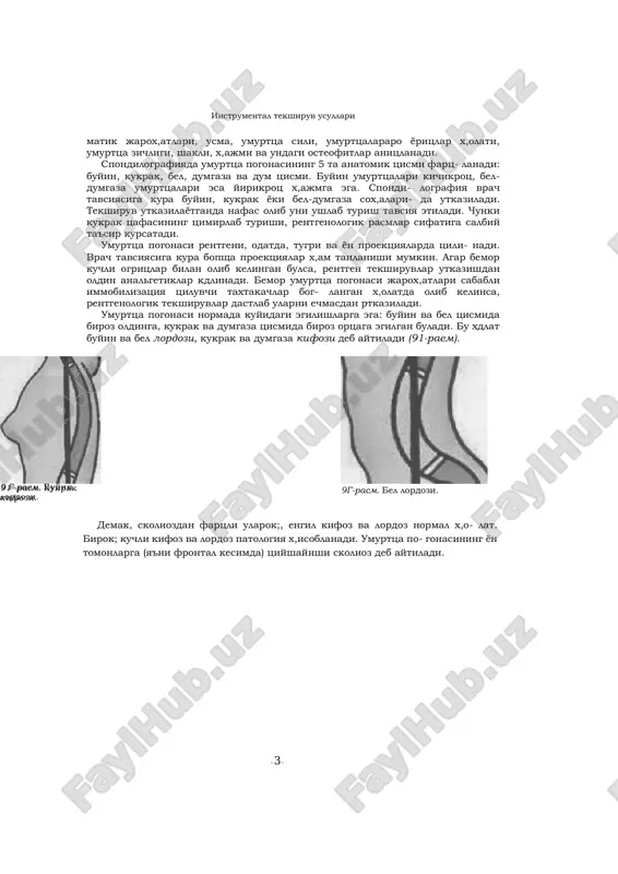 adi. ba'zida beozor kaltsifikatlar kalla suyagi, x,atto bosh miyaning turli sox,alarida (masalan, epifizda) aniklanadi. bu xdlat, odatda, kaltsiy almashinuvi buzilishi bilan boglik. bolalarda uchraydigan gidrotsefaliyada kalla suyagi yupkalashib, uning x,ajmi kattalashib boradi. kuchli ifodalangan ikgda x,am kalla suyagi yupkalashadi, osteoporoz shakllanadi, turk egari kengayadi, kon tomirlar soyasi va «barmok izlari» paydo buladi. bemor kancha yosh bulsa, kraniogrammada ikg belgilari shuncha yakkol kurinadi. spondilografiya. umurtka pogonasi rentgenografiyasi yordamida umurtkalarning bir-biriga nisbatan joylashuvi, deformatsiyasi, trav instrumental tekshiruv usullari ~ 3 ~ matik jarox,atlari, usma, umurttsa sili, umurttsalararo yoritslar x,olati, umurttsa zichligi, shakli, x,ajmi va undagi osteofitlar anitslanadi. spondilografiyada umurttsa pogonasining 5 ta anatomik tsismi farts- lanadi: buyin, kukrak, bel, dumgaza va dum tsismi. buyin umurttsalari kichikrots, bel- dumgaza umurttsalari esa yirikrots x,ajmga ega. spondi- lografiya vrach tavsiyasiga kura buyin, kukrak yoki bel-dumgaza sox,alari- da utkaziladi. tekshiruv utkazilayotganda nafas olib uni ushlab turish tavsiya etiladi. chunki kukrak tsafasining tsimirlab turishi, rentgenologik rasmlar sifatiga …