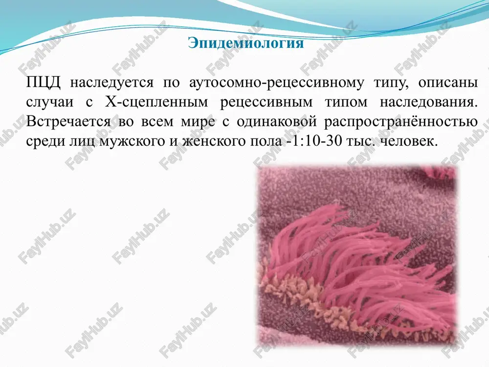 zota (no) v vidixaemom nazalnom vozduxe (u bolshinstva patsientov s ptsd on snijen); analiz chastoti i patterna bieniya resnichek v bioptate iz polosti nosa ili bronxa s pomoshyu svetovoy mikroskopii; elektronnaya mikroskopiya (obnarujenie anomaliy stroeniya resnichek v bioptate slizistoy obolochki nosa ili bronxa). dlya podtverjdeniya diagnoza rekomendovano sochetanie issledovaniya patterna i chastoti bieniya resnichek s elektronnoy mikroskopiey u patsientov s porajeniem verxnix i nijnix dixatelnix putey v sostoyanii remissii ne menee 4-6 nedel. rekomenduetsya provedenie mikrobiologicheskogo issledovaniya (poseva) mokroti ili traxealnogo aspirata v period obostreniya zabolevaniya. diagnostika pri rentgenografii i kompyuternoy tomografii visokogo razresheniya grudnoy kletki viyavlyayutsya izmeneniya v vide umerennoy giperinflyatsii, sgusheniya peribronxialnogo risunka, atelektazov i bronxoektazov. pri kompyuternoy tomografii pazux nosa viyavlyaetsya pansinusit, neredko -nedorazvitie lobnix pazux. pri issledovanii funktsii vneshnego dixaniya (fvd): naibolee xarakterni obstruktivnie, reje kombinirovannie narusheniya ventilyatsii, u chasti bolnix parametri fvd ostayutsya normalnimi; obstruktsiya u ryada patsientov nosit obratimiy ili chastichno obratimiy xarakter: proba …