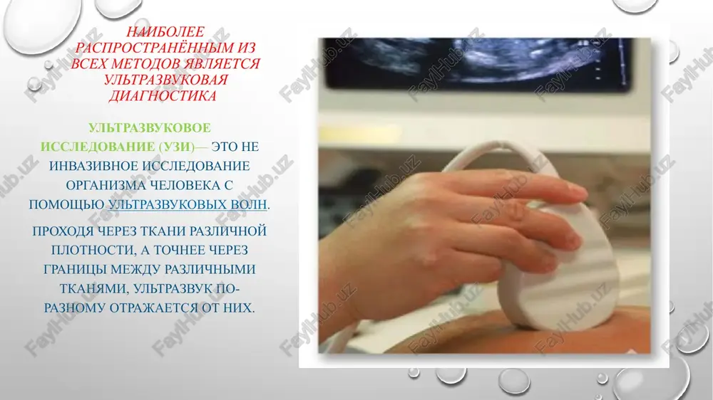 hto uvelichivaet vremya prosvechivaniya. dannoe obstoyatelstvo privodit k poyavleniyu iskajeniya snimkov, v chastnosti ot dixatelnix dvijeniy (diagnostika legkix i serdtsa). 3. nevozmojnost viyavleniya nekotorix vidov patologiy v kostnoy strukture. 4. zatrudnenie diagnostiki patsientov s nalichiem simptomov klaustrofobii (boyazn zakritogo prostranstva), metallicheskimi krupnimi implantatami, iskusstvennim voditelem ritma. doplerografiya dopplerovskoe skanirovanie prednaznacheno, prejde vsego, dlya izucheniya tsirkulyatsii krovi v arteriyax i venax. pri etom skanirovanii ne ispolzuyutsya rentgenovskie luchi. doplerovskiy metod osushestvlyaetsya bez vtorjeniya v organizm kakim-libo sposobom, v tom chisle i xirurgicheskim. preimushestva doplerografii oni visokoinformativnie. pozvolyayut viyavit samie rannie doklinicheskie priznaki sosudistix zabolevaniy, otsenit porajeniya sosudov i narusheniya krovotoka. yavlyayutsya neinvazivnimi i absolyutno bezopasnimi. endoskopiya eto sposob issledovaniya i osmotra opredelennix vnutrennix organov s pomoshyu endoskopa. eto pozvolyaet opredelit vizualnuyu diagnostiku pri pomoshi videokameri, kotoraya krepitsya na kontse trubki, nazivayusheysya endoskopom. vidi endoskopii planovaya endoskopiya ekstrennaya endoskopiya srochnaya endoskopiya otsrochennaya endoskopiya kápsulnaya endoskopíya eto meditsinskoe obsledovanie tolstogo i tonkogo kishechnika, …