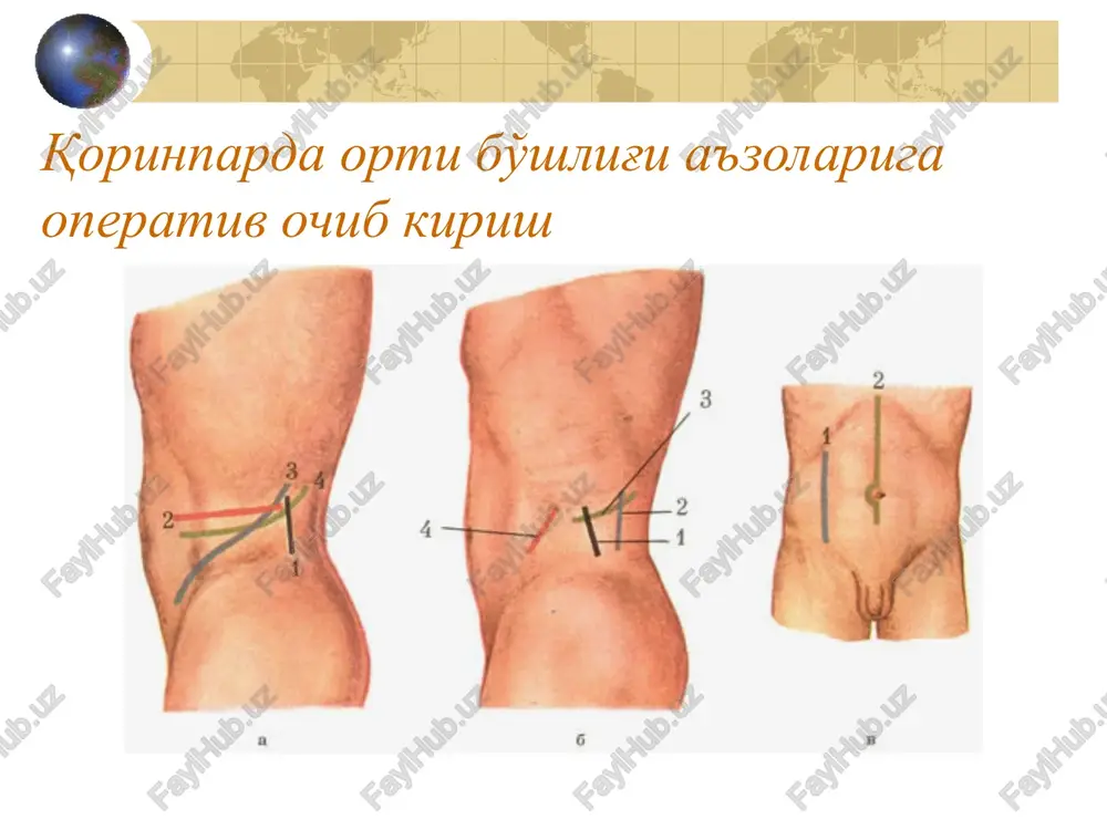 qorinparda ortibo'shlig'i klinik anatomiyasi - Page 3