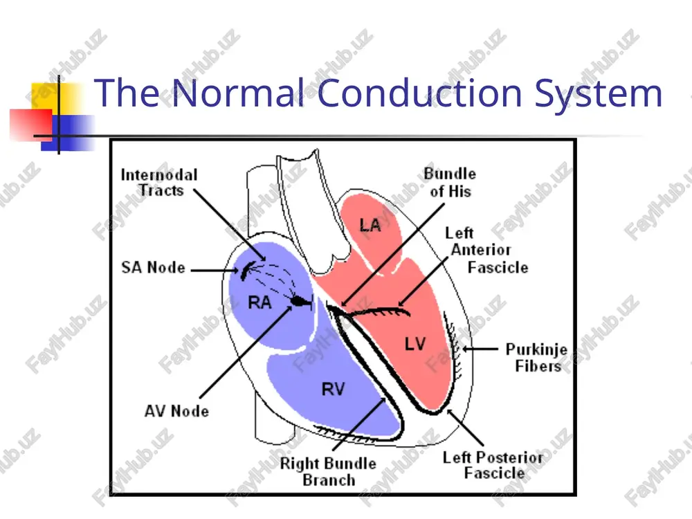 al tracts the standard limb leads standardization amv. a se q bipolar limb leads —> augmented unipolar limb leads 0 ave +90" +120" 160° septal == rr interval qrs complex titi riera 4 i j | | pr st h} gent {gear +t | “ i j at v at] ae -90° indeterminate lead avf positive negative positive normal lad axis lead! negative rap __ | indeterminate axis qrs qrs in lead in lead ave normal axis bois oe us = pie! pl > nge roi bllter et pees atel “ll cree heese reel eer restgs eee neil teste pal a a ate i aed se a a aia ad glia ie getre cnenss tues tele geel ceese ape ea ug se hace pe, | peledbbtbelnd eld yyspic eae 1 ob apr-i9h 181 (© 1997 frank g. yanowitz, m.d. ecgs for the emergency physician amal matta and william brady an …