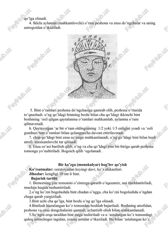 hi) o’ram peshona va ensa do’ngchalar va uning astrogoidan o’tkaziladi. 5. bint o’ramlari peshona do’ngchasiga qamrab olib, peshona o’rtasida to’qnashadi. o’ng qo’ldagi bintning boshi bilan cha qo’ldagi ikkinchi bint boshining ‘osil qilgan qaytalanma o’ramlari mahkamlab, aylanma o’ram qilinaveradi. 6. qaytayotgan ‘ar bir o’ram oldingisining 1/2 yoki 1/3 enligini yoadi va ‘osli gumbazi bint o’ramlari bilan qolanguncha davom ettirilaveradi. 7. chap qo’ldagi bint ensa so’asiga mahkamlanadi; o’ng go’ldagi bint bilan bosh atrofi maxkamlovchi tur qilinadi. 8. ensa so’asi burilish qilib, o’ng va cha qo’ldagi bint bir-biriga qarab peshona tomonga yo’naltiriladi. bogoich qilib ‘ogolanadi . bir ko’zga (monokulyar) bog’lov qo’yish ko’rsatmalar: oeratsiyadan keyingi davr, ko’z shikastlari. jihozlar: kengligi 10 sm li bint. bajarish tartibi. 1. bemorning yuz tomonini o’zimizga qaratib o’tqazamiz, uni tinchlantiriladi, muolaja haqida tushuntiriladi. 2.o’ng ko’zni bogolashda bint chadan o’ngga, cha ko’zni bogolashda o’ngdan chaga qarab yurgiziladi. 3.bint uchi cha qo’lga, bint boshi o’ng qo’lga olinadi. 4.bintlash hastalangan ko’z tomondan …