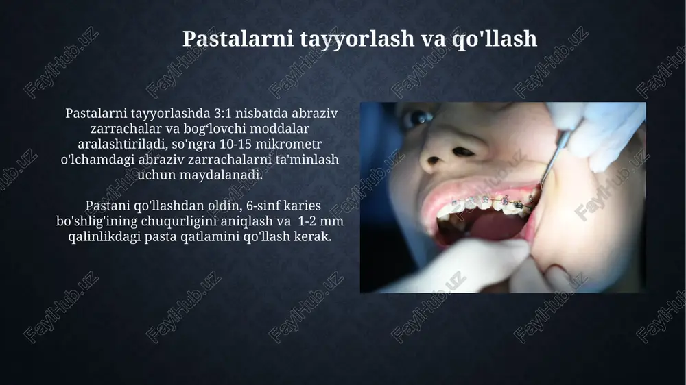 akteriyalarni 99.99% ga yo'q qiladi. tozalash jarayonida 6-sinf karies kavitetidan 3-4 mm chuqurlikdagi kariesli to'qimalarni to'liq olib tashlash kerak, bu esa sterillashtirish samaradorligini oshiradi. polishing texnikasi tanlovi pastaning turidan (almas, silikon oksidi) va abraziv zarrachalar hajmidan (1-5 mkm) qat'iy nazar, polishing texnikasini tanlashda kuch va bosimni nazorat qilish muhim ahamiyatga ega. ortiqcha bosim emalning shikastlanishiga olib kelishi mumkin. 6-yoshli bolalardagi kariesli bo'shliqlarni abrazivligi 50-100 mkm bo'lgan polishing pastalari yordamida polishing qilish, yuqori darajadagi yaltiroqlik va sirt silliqligini ta'minlaydi. 6-sinf karies kavitasi abraziv materiallari 6-sinf karies kavitasi abraziv materiallari sifatida 10-30 mkm o'lchamli alyuminiy oksid zarrachalari yuqori samaradorlik ko'rsatkichiga ega bo'lib, minimal invaziv preparatsiya uchun ideal hisoblanadi. ftoridli abraziv pastalarni 6-sinf karies kavitasi polirovkasida qo'llash, emal remineralizatsiyasini kuchaytirish va kariesning qayta rivojlanish xavfini 15-20% ga kamaytirishga yordam beradi. e'tiboringiz uchun rahmat @taqdimot_robot image2.jpg image3.jpg image4.jpg image5.jpg image6.jpg image7.jpg image8.jpg image9.jpg image10.jpg image11.jpg image12.jpg image13.jpg