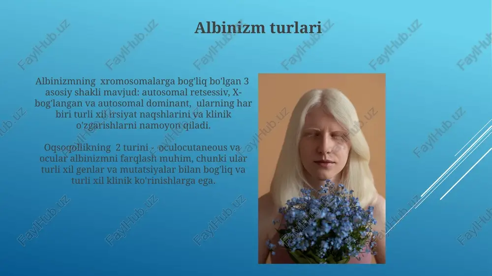 albinizm kasalligi - Page 3