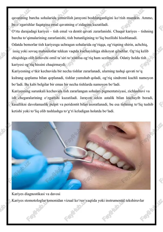 – tish emal va dentit qavati zararlanishi. chuqur kariyes – tishning barcha toʻqimalarining zararlanishi, tish butunligining toʻliq buzilishi hisoblanadi. odatda bemorlar tish kariyesga uchragan sohalarida ogʻriqqa, ogʻriqning shirin, achchiq, issiq yoki sovuq mahsulotlar tekkan vaqtda kuchayishiga shikoyat qiladilar. ogʻriq kelib chiqishiga olib keluvchi omil taʼsiri toʻxtatilsa ogʻriq ham sezilmaydi. odatiy holda tish kariyesi ogʻriq hissini chaqirmaydi. kariyesning oʻtkir kechuvida bir necha tishlar zararlanadi, ularning tashqi qavati toʻq kulrang qoplama bilan qoplanadi, tishlar yumshab qoladi, ogʻriq sindromi kuchli namoyon boʻladi. bu kabi belgilar bir emas bir necha tishlarda namoyon boʻladi. kariyesning surunkali kechuvida tish zararlangan sohalari pigmentatsiyasi, zichlashuvi va ish chegaralarining oʻzgarishi kuzatiladi. jarayon sekin astalik bilan kuchayib boradi, kasallikni davolamaslik pulpit va peridontit bilan asoratlanadi, bu esa tishning toʻliq tushib ketishi yoki toʻliq olib tashlashga toʻ​gʻri keladigan holatda boʻladi. kariyes diagnostikasi va davosi kariyes stomotologlar tomonidan vizual koʻruv vaqtida yoki instrumental tekshiruvlar yordamida aniqlanadi. bemordagi shikoyatlar kariyes tashxisini qoʻyish uchun …