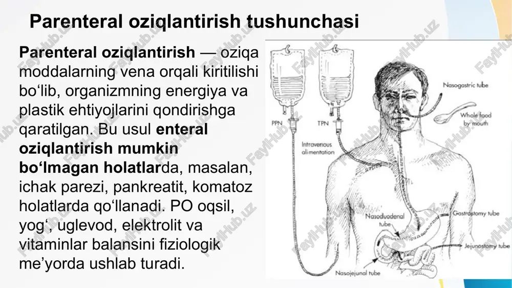 iya almashinuvida, c vitamini kollagen sintezida, a va e vitaminlari antioksidant himoyada muhim. parenteral komplekslarda suvda eruvchan va yog‘da eruvchan vitaminlar alohida eritmalarda yuboriladi. ko‘pincha soluvit® va vitalipid® eritmalari kombinatsiyasi ishlatiladi. ular immunitetni va regeneratsiyani qo‘llab-quvvatlaydi. energetik talabni hisoblash organizmning energetik talabi bazal metabolizm, jismoniy faollik va patologik jarayonlardan kelib chiqib belgilanadi. bazal energiya sarfi schofield yoki harris–benedict formulasi asosida hisoblanadi. og‘ir jarrohlik, kuyish yoki sepsisda talab 30–40 kkal/kg/gacha oshadi. energiya manbalari nisbati: uglevodlar — 50–60%, yog‘lar — 25–30%, oqsillar — 15–20%. shunga muvofiq infuzion rejim tuziladi. harris–benedict formulasi bazal metabolik tezlik (bmr)ni hisoblash uchun quyidagi tenglama qo‘llanadi: erkaklar uchun: 66.5 + (13.75 × massa) + (5 × bo‘y) − (6.78 × yosh). ayollar uchun: 655 + (9.56 × massa) + (1.85 × bo‘y) − (4.68 × yosh). schofield formulasi (shofild formulasi) — bu bazal metabolik tezlik (bmr – basal metabolic rate) ni hisoblash uchun ishlab chiqilgan energiya sarfini baholovchi …