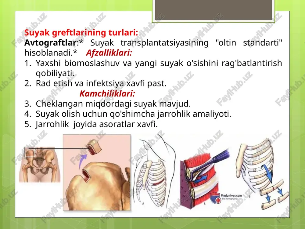 asoratlar. avtograflar biologik mosligi va osteoinduktivligi tufayli suyak transplantatsiyasining" oltin standarti " bo'lib qolmoqda. biroq, mavjud suyakning cheklangan miqdori va uni olish uchun qo'shimcha jarrohlik zarurati cheklovchi omillar bo'lishi mumkin. allograftlar va sintetik materiallar muqobil yechimlarni taklif qiladi, ayniqsa suyak nuqsonlari katta bo'lgan hollarda yoki avtografni olish imkonsiz bo'lsa. texnologiyaning rivojlanishi allograftlar va sintetik materiallarning xususiyatlarini yaxshilashga, ularning biologik mosligi va past qarshiligini oshirishga imkon beradi. kelajakda suyak transplantatsiyasining yangi materiallari va texnologiyalari paydo bo'lishini kutish mumkin, bu esa suyak to'qimasini tiklash imkoniyatlarini yanada kengaytiradi. mavjud xavf va cheklovlarga qaramay, suyak transplantatsiyasi mushak-skelet tizimining ko'plab kasalliklari va shikastlanishlari uchun samarali davolash usuli hisoblanadi foydalanilgan adabiyotlar "bone grafting" (robert e. marx, scott p. taylor) "a clinical guide to bone regeneration: techniques and materials" (michael s. block) "bone augmentation in implant dentistry" (istvan urban) "journal of bone and joint surgery", "clinical orthopaedics and related research", "international journal of oral and maxillofacial surgery“ …