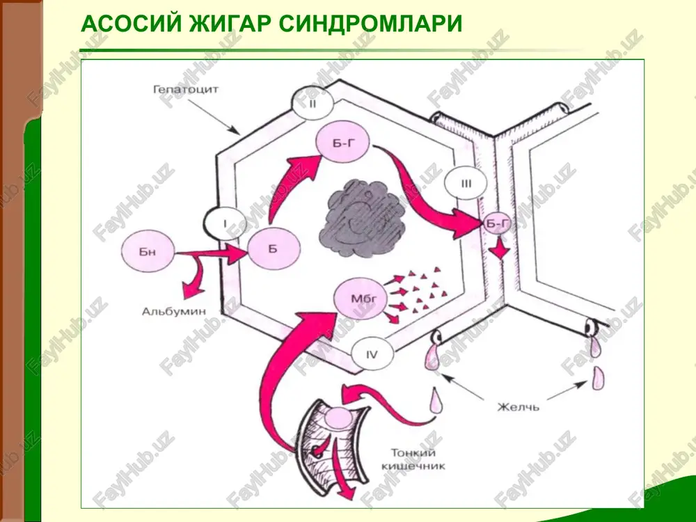 alarining kuplab emirilishi yalliglanish, immunopatologik, erkin radikalli reaktsiyalarning kushimcha kuchayishi jigar-xujayra etishmovchiligi jigar-xujayra etishmovchiligining asosiy umumiy zvenolari jigar etishmovchiligi shikoyatlar: keskin xolsizlik ishtaxa yo'qolishi dispeptik ko'rinishlar isitma sariqlik shishlar meteorizm astsit teri gemorragiyasi, burundan, to'g'ri ichakdan qon ketishi ginekomastiya, xayz ko'rishning buzilishi jigar etishmovchiligi ko'zdan kechirish: ozish sariqlik gemorragik toshmalar «tomir yuldizchalari» «jigar kafti» astsit paypaslash (palpatsiya) jigar va taloqning kattalashishi jigar etishmovchiligi jigar etishmovchiligini terminal davri oksillar, ammiak, fenol ajratadigan maxsulotlar bilan zaxarlanish - bosh miyaning toksik shikastlanishi, asabiy-ruxiy buzilish. 4 bosqichi farqlanadi: koma oldi: vaxima, siqilish, sekin fikrlash, atrof-muxitga notugri baxo berish, uykusizlik, ishtaxaning yukolishi, ogizdan «jigar» xidining kelishi, sariklik. rivojlanayotgan koma: psixoz kuchayib, depressiyaga utadi, dezorientatsiya; kul barmoklari, lablar, kovoklarning kaltirashi, ogizdan «jigar» xidi keladi, sariklik kuchayadi. stupor koma e'tiboringiz uchun rahmat ! a, = sputpounter > . 427 knerxu psc gt sf bunupy6un (ceo6.) kposp: bunupy6un a (cb06.) “a ‘at i ‘ in it it hh …